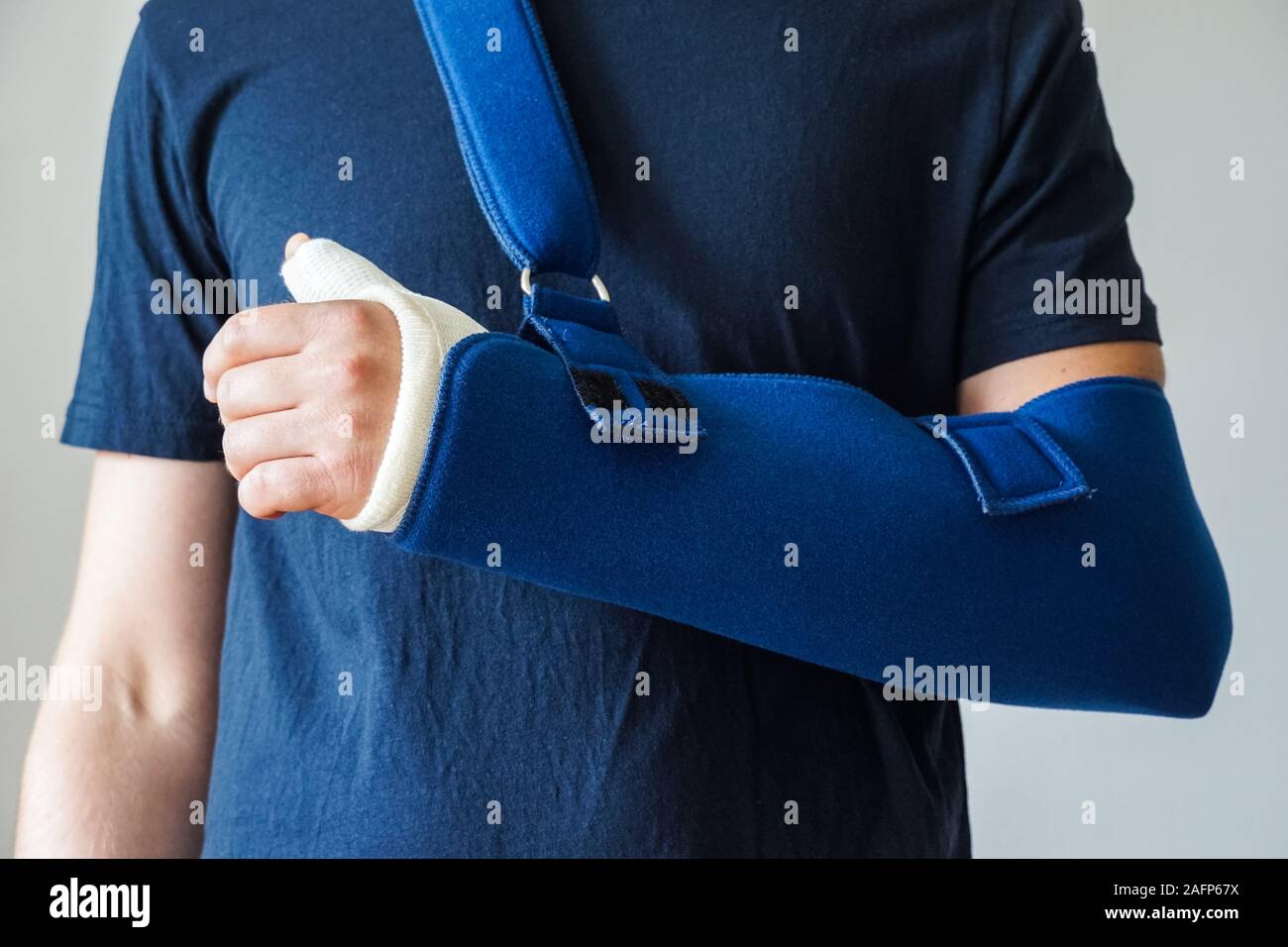 Homme avec plâtre sur le pouce cassé, fracture du poignet, fracture de la main sur le bras sling Banque D'Images