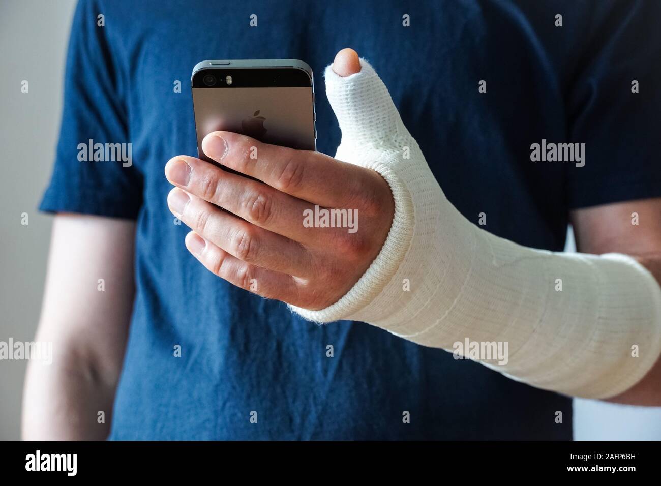 Homme avec plâtre sur fracture de la main, pouce cassé, fracture du poignet using smartphone Banque D'Images