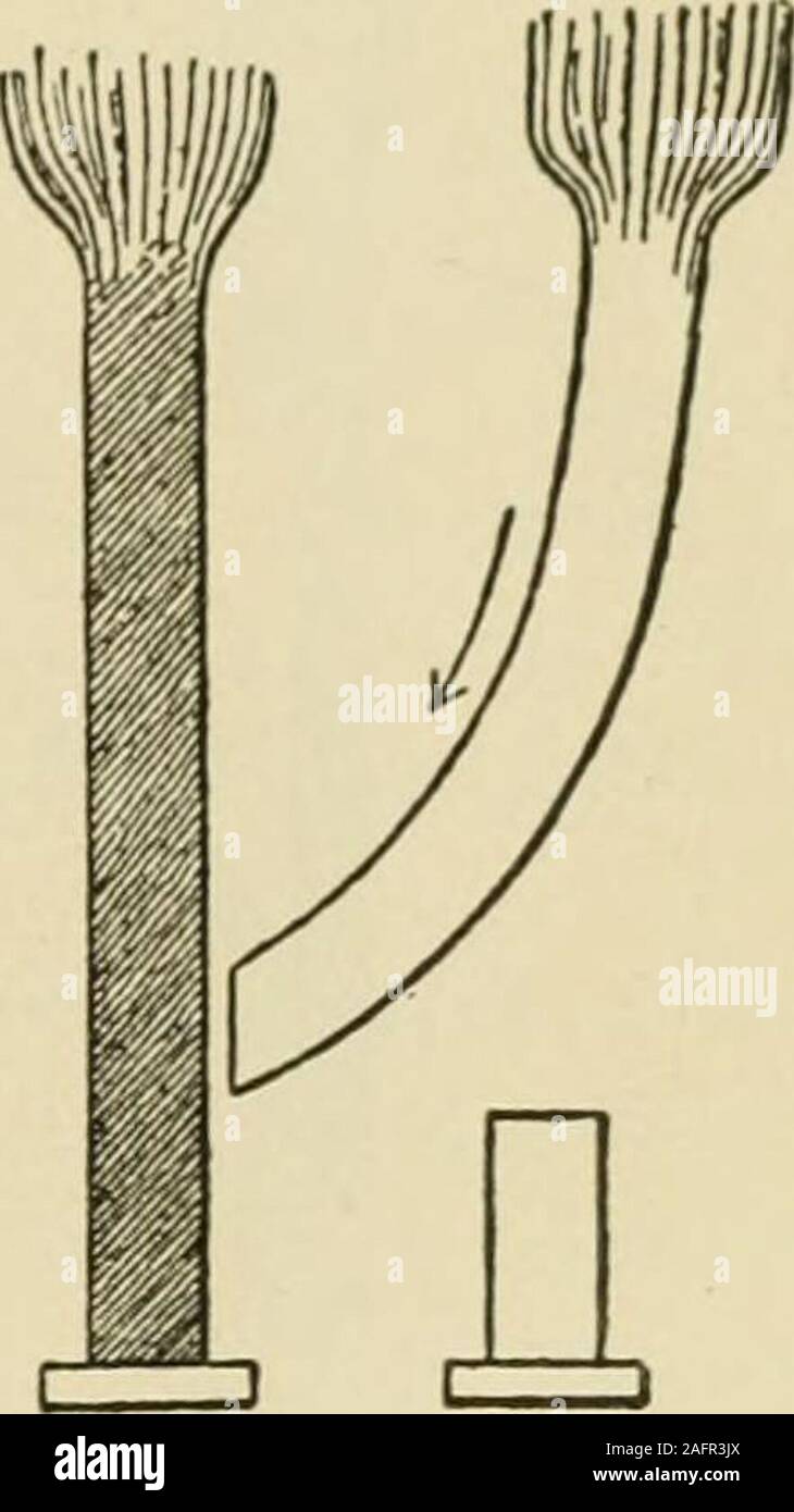 . Manuel de chirurgie opératoire. Fig. 1529. Fig. 1530. Fig. 1531. Tensions est sécurisé pour permettre de transfert ou l'application du point de l'powerto musculaire d'insertion tendineuse. Un tendon lax entre le muscle et l'ofinsertion point est inutile. Dans la Fig. 1526 les tendons à la fois du donneur et du receveur sont com-plètement divisé et la partie périphérique du donateur est jeté, c.-à-d., aucune Banque D'Images
