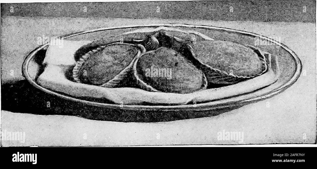 . Le siècle cook book : avec un nouveau supplément d'une centaine de recettes de especial l'excellence. STEAKS de poisson bouilli ou sautés, garni de boules, DE POMMES DE TERRE-WATEE CEESS, et de citron.. CBEAMBD DANS POISSONS COQUILLAGES, PISH 12E de l'eau chaude, et laissez la vapeur dans un four^ pendant dix ou quinze minutes Tites. ^ Gamme pièces standing on end autour d'un socle de ric"ou hominy (voir page 326)  ; le masque haut de la socle aux gambas,ou de persil, ou avec de l'eau cresses, et quelques oipink œillets roses roses. Servir avec sauce hollandaise sance, greeiior de couleur rose. Les escalopes rose peut être garnie avec des câpres, ou avec un thinslice Banque D'Images