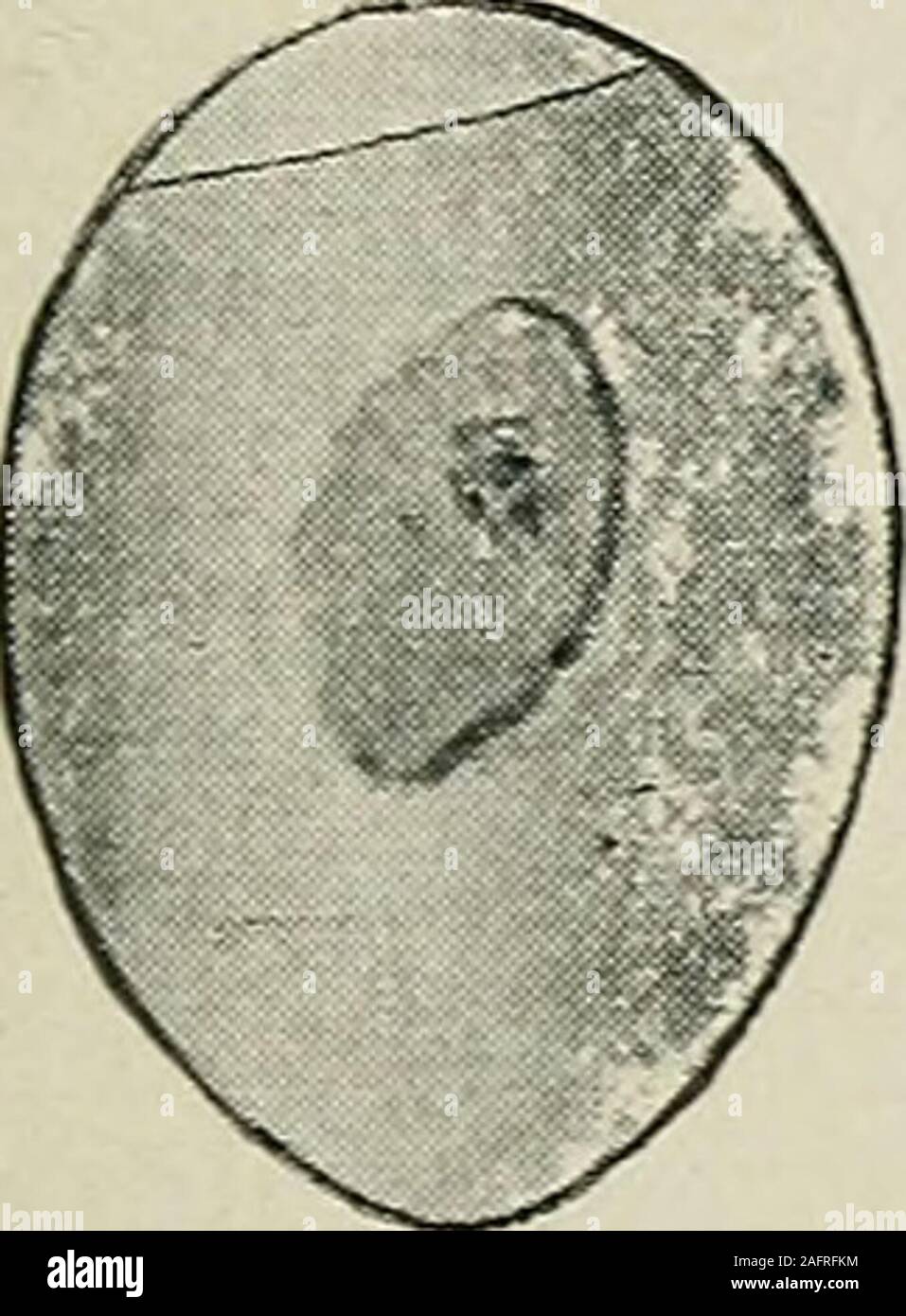 . Biggle livre de volaille ; un exposé concis et pratique traité sur la gestion de la volaille de ferme. adiate. Il y a également un léger trouble sur place ou thisdark germe, et le germe peut être vu à se déplacer un peu comme l'eggis a tourné. Il arrive souvent que le germe commence à developand meurt avant le sixième jour. Dans ce cas, l'indistinct, ou compressé sont absents, et dans leurs place est un cercle foncé germe comme enclosingthe apparaît dans la Figure 4. Lorsque l'oeuf est tourné ce embryofloats morts sans but dans l'ing-surround contenu. Tous les œufs stériles qui ont été freshwhen remainclear ont commencé, d'incubation Banque D'Images