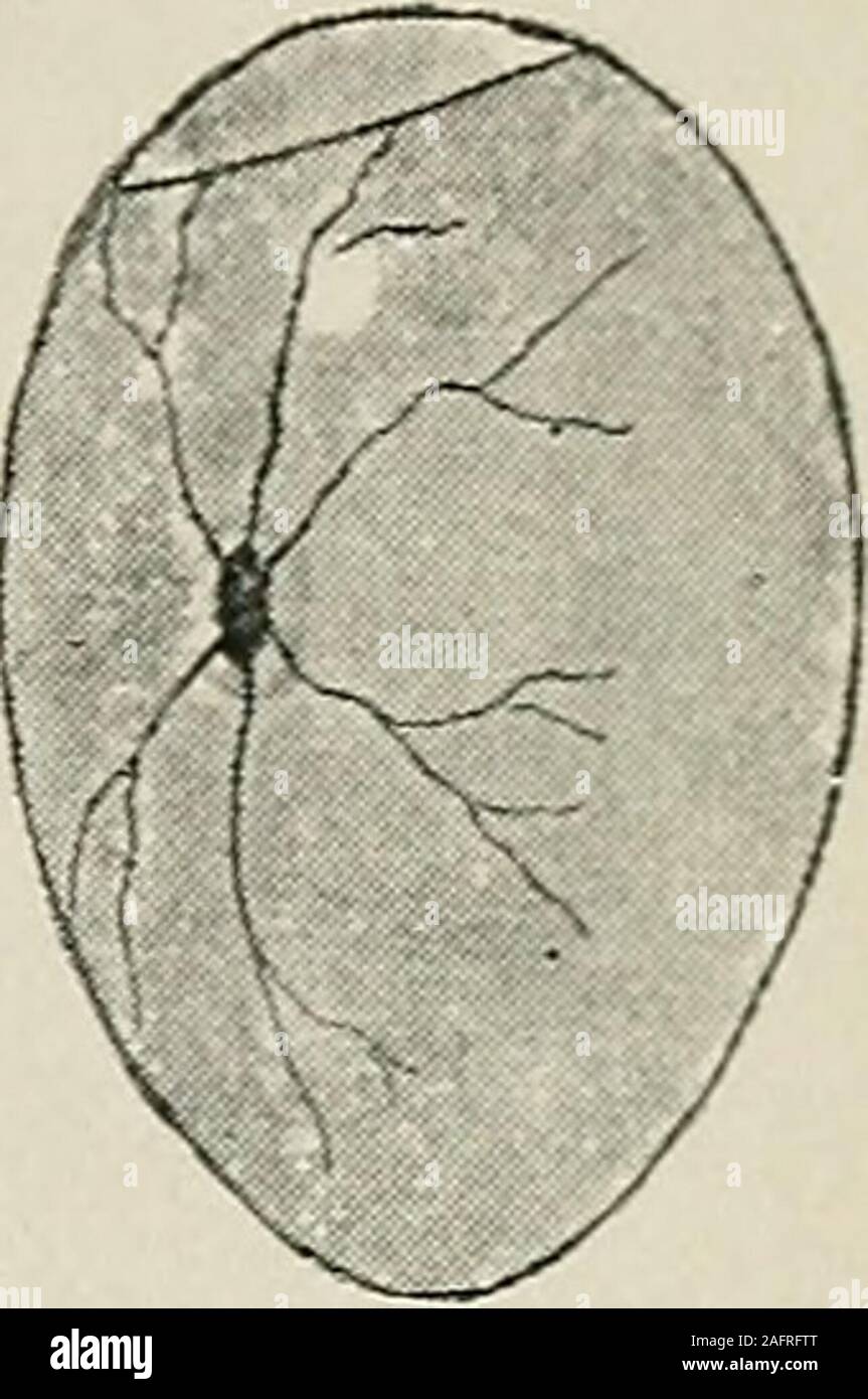 . Biggle livre de volaille ; un exposé concis et pratique traité sur la gestion de la volaille de la ferme. L'oeuf. 17. Fig. 3. Sur le cinquième ou sixième jour d'incubateur INCU-site bation, une forte volonté d'oeufs fertiles, looklike Figure 3. Le sac est slightlyenlarged-air et d'un centre foncé finered lignes sont vus à rayonner. Il y a également un léger trouble sur place ou thisdark germe, et le germe peut être vu à se déplacer un peu comme l'eggis a tourné. Il arrive souvent que le germe commence à developand meurt avant le sixième jour. Dans ce cas, l'indistinct, ou compressé sont absents, et dans leurs place est un cercle foncé enclosingthe ger Banque D'Images