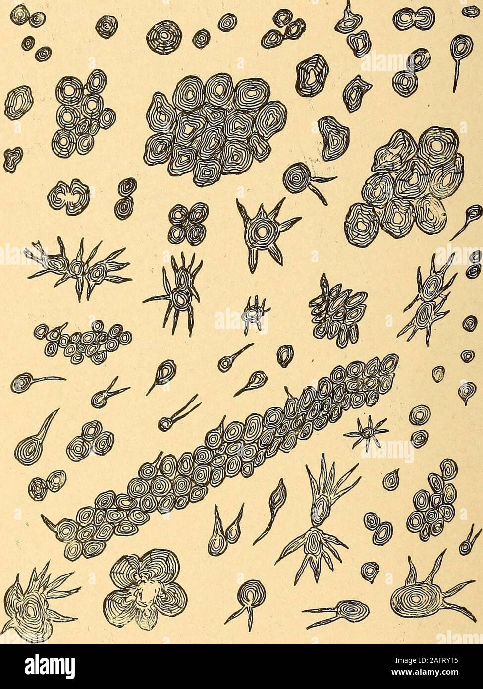. L'analyse urinaire et le diagnostic par examen microscopique et chimique. Fig. 37.-phosphates simples en forme d'Étoile (X 500). peut avoir un diamètre uniforme ou être élargi à la périphérie et nar-ramé dans le centre. On a beaucoup écrit sur l'importance de la présence de phosphates dans theurine, et beaucoup de stress a été déposé sur leur ordiminution continue d'augmenter, ce dernier étant considéré comme de présence constante dans les cas ofnephritis. C'est un fait indéniable que les phosphates sont diminués 88 ANALYSE ET DIAGNOSTIC URINAIRE. De graves et généralement des cas avancés de néphrite, mais ce n'est plus Banque D'Images