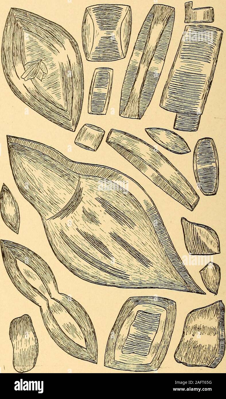 . L'analyse urinaire et le diagnostic par examen microscopique et chimique. ce qui suit : A. LES SÉDIMENTS. 1. L'acide urique 2. L'urate de sodium (a) Commune y amorphe(6) 3 cristalline. L'oxalate de calcium 4. Cystine 5. Creatinin [ 6. L'acide hippurique Y rares. 7. Je Leucin 8. Tyrosin J 9. Sulfate de calcium.-Très rare. B. LES SÉDIMENTS ALCALINES. 1. Les phosphates ou triple-magnesiaii ammonio phosphates (a) (b) incomplet 2. Les phosphates simples ou les phosphates de calcium amorphe (a) (6), en forme d'étoiles ou d'3. L'urate d'ammonium 4. Le carbonate de calcium.-rare. 5. Phosphate de magnésium.-Très rare. A. LES SÉDIMENTS DE L'ACIDE. 1. Uri Banque D'Images