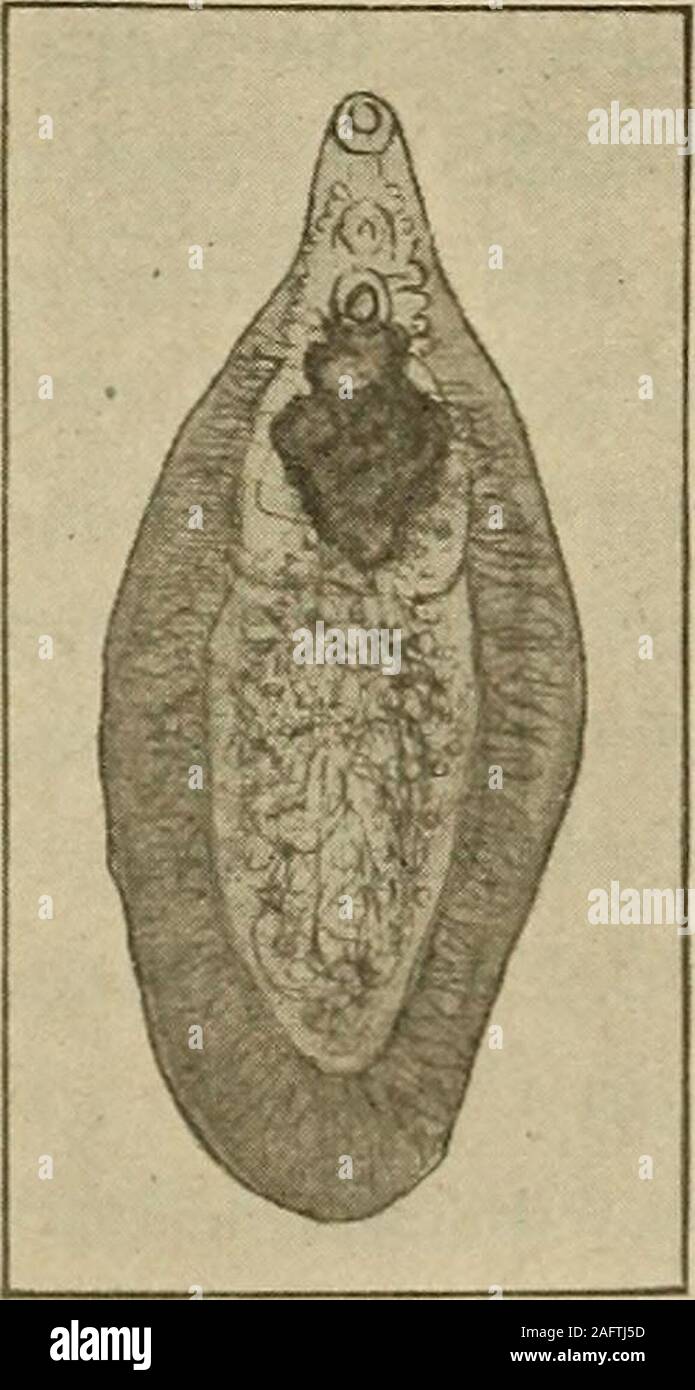 . Diagnostic médical pour l'étudiant et le praticien. Fig. 551.-homme {a) et femelle (6) ofBilharzia hemalobia. {Après Looss.) Fig. 552.-Fasciola hepatica. Symptômes.-La description ci-dessus indique que le siège, la nature diverse,et divers symptômes, qui sont bien sûr principalement ceux de l'hématurie, abcès, et l'irritation de l'appareil urinaire., selles dysentériques, soignes-Glis rarement une cirrhose et un degré variable de l'anémie. Le diagnostic dépend de la caractéristique trouver uponthe les œufs. La Fasciola hepatica ou Distomum hepaticum de moutons, un petit fluke, 1154 DIAGNOSTIC MÉDICAL de 20 à Banque D'Images