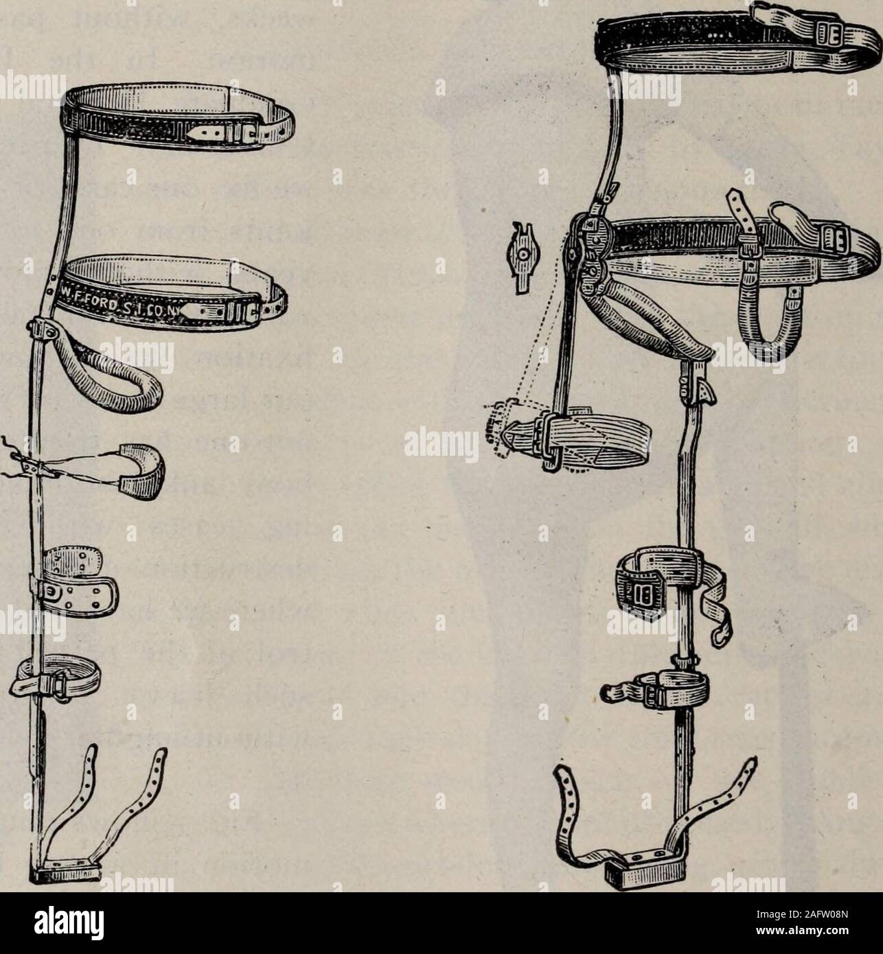 . Buffalo medical journal. Fig. 7- 92 PHELPS : MALADIE TUBERCULEUSE DE LA COLONNE ET DE LA HANCHE. la loi. Il est appliqué dans le traitement de l'iris, fracture, entorse,et tout autre tissu qui peut être immobilisé. Pour mener à bien des exigences de la présente loi dans la mesure du possible, j'ai été conduit à des attelles de devisethese illustré dans cet article. Pour fixer la hanche-asplint mixte, doit s'étendre depuis le pied à l'épaule. (Voir Fig. 2, 3, 4 et 6.) Fig. 3 représente la béquille du périnée avec enlèvement baradjustible au moyen de la touche, dans le but de faire- latéral. Fig. 2.-la à peu de dis- Fig. 3.-Bar à l'intérieur et Latei Banque D'Images