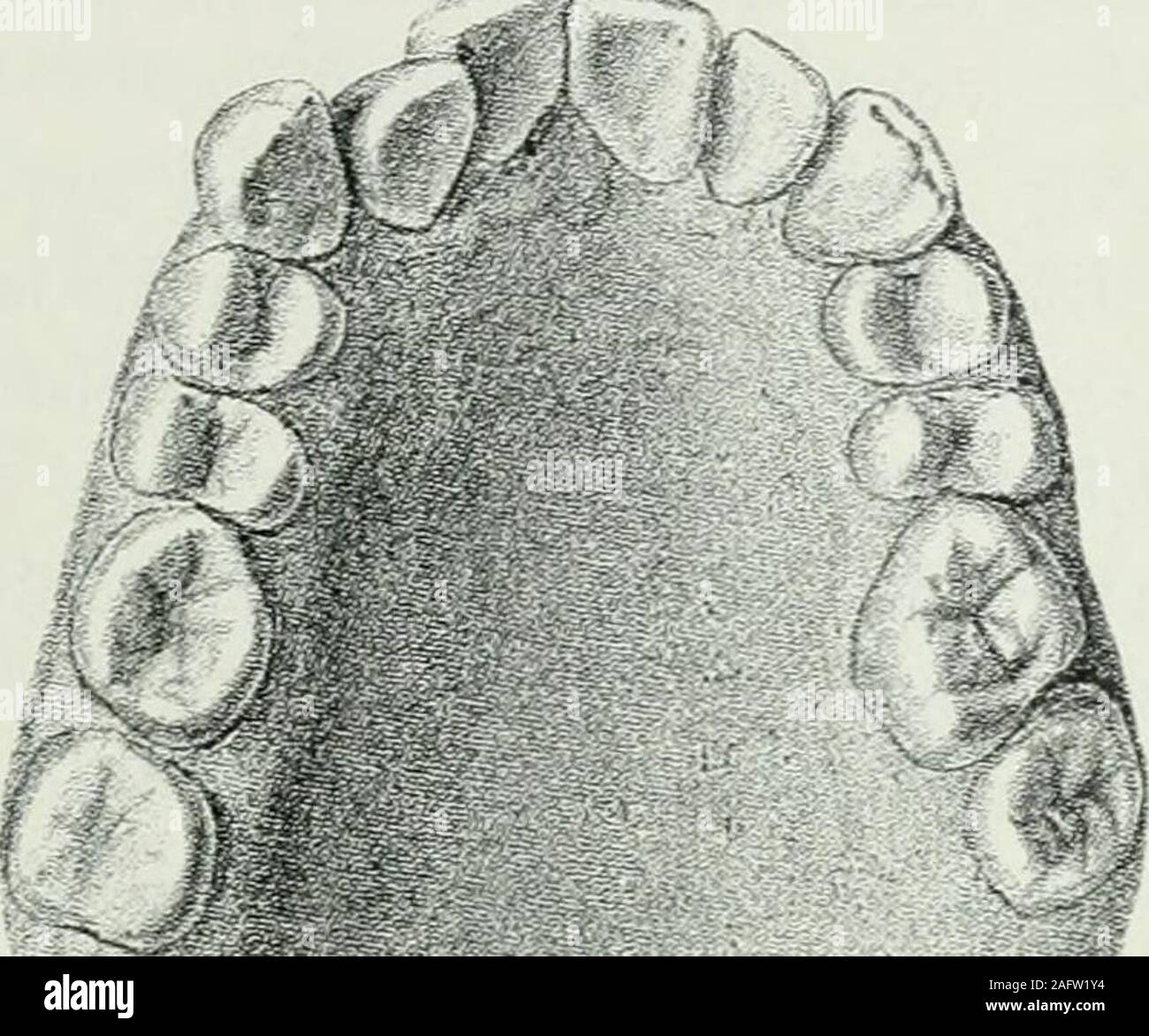 . Lehrbuch der orthodontie fur studierende und zahnartze enschluss mit der Geschichte der zweiten. aschvorrückenden Molaren orthodontie okku-piert, erst noch und als nun die erschienen drittenMolaren einzusehen - ungünstigen Erfolge, behauptet er einfach, diese ex-traktion gar nicht einmal genügt habe, sondern hier il esbesser gewesen, auch noch die ersten Bikuspidaten (sie !) zu fernen-ent. Hier la guerre einzig und allein die Extraktion der erstenBikuspidaten suis Platze, vorausgesetzt natürlich, dass man über-haupt die Extraktion für das einzig richtige Mittel der. Die I. Prophylaktische Maßregeln Banque D'Images