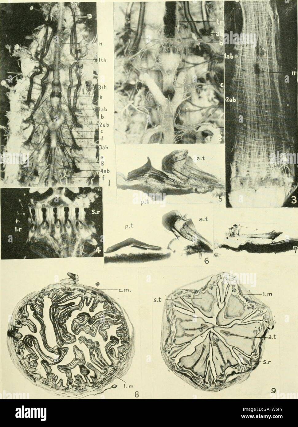 Partie De L Intestin Grele En 5 Lettres Vue latérale de l'intestin grêle et du gros intestin Banque de  photographies et d'images à haute résolution - Alamy