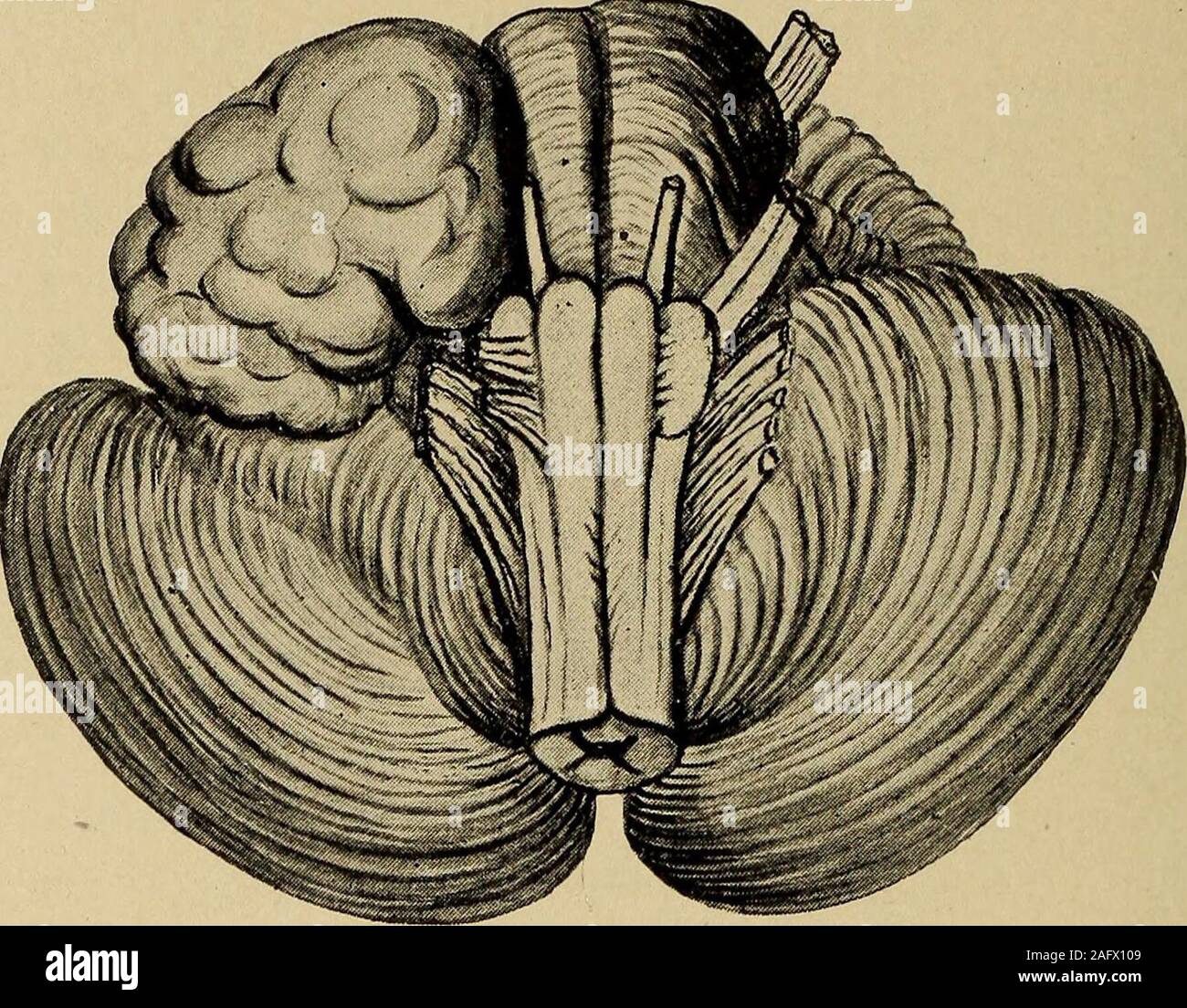. Un traité sur les maladies nerveuses des enfants, pour les médecins et étudiants. de le vermis sont responsables d'une tendance à fallforward ou en arrière. Une tumeur du cervelet peuvent être de très petite taille et yetsufficiently grande pour comprimer les sixième, septième et huitième nerfs, et dans itsfurther peut produire la croissance de la participation des nerfs bulbaires ainsi, juste astumor de l'ampoule peut aussi produire des symptômes cérébelleux. L'affection de la 480 LES MALADIES DE L'ENFANT nerveux le sixième nerf, entraînant une paralysie des muscles grand externus, est très commonin les tumeurs du cervelet et, dans certains cas, la diagnosi Banque D'Images . Un traité sur les maladies nerveuses des enfants, pour les médecins et étudiants. de le vermis sont responsables d'une tendance à fallforward ou en arrière. Une tumeur du cervelet peuvent être de très petite taille et yetsufficiently grande pour comprimer les sixième, septième et huitième nerfs, et dans itsfurther peut produire la croissance de la participation des nerfs bulbaires ainsi, juste astumor de l'ampoule peut aussi produire des symptômes cérébelleux. L'affection de la 480 LES MALADIES DE L'ENFANT nerveux le sixième nerf, entraînant une paralysie des muscles grand externus, est très commonin les tumeurs du cervelet et, dans certains cas, la diagnosi Banque D'Images