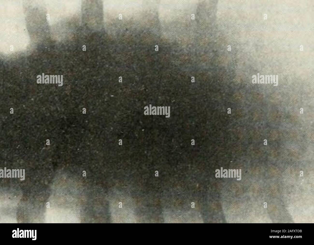 . Opérations du sixième congrès international sur la tuberculose. Washington, le 28 septembre au 5 octobre 1908. rganiza-tion de la masse par le tissu conjonctif. Une exception à cela a été mieux notéesles Dr. Joseph C. Beck dans un cas d'empyème de l'antre d'Highmore, quand, après une guérison complète avec la méthode de bismuth, la cavité n'bedemonstrated au moyen d'une sonde ainsi que par transillumination. Incavities avec parois résistantes, telles que la cavité pleurale, l'expan-sion du poumon se réoccuper l'espace résultant de l'absorption de bismuthpaste. Cette affirmation peut être prouvée, la FIRS Banque D'Images