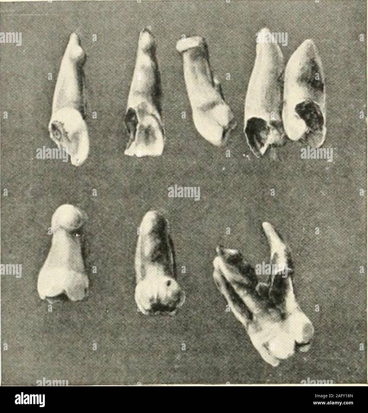 . La science et la pratique de la chirurgie dentaire. ment éclaté, et Ijingmore ou moins horizontalement, touché contre thesecond, molaire et ayant ses racines embedded os indense sous la base de l'coronoidprocess. Si la dent est en partie erapted softparts la peut être actionné de côté par l'emballage jusqu'à aclear view de la couronne est obtenu. Beaucoup d suchteeth peut être saisi et extraites par le forceps,mais ascenseur est souvent le appropriateinstrument. Dans certains cas, il peut être nécessaire de découper un os pour exposer le situationof la dent, et une radiographie peut être ofvalue. On entend et lit o Banque D'Images