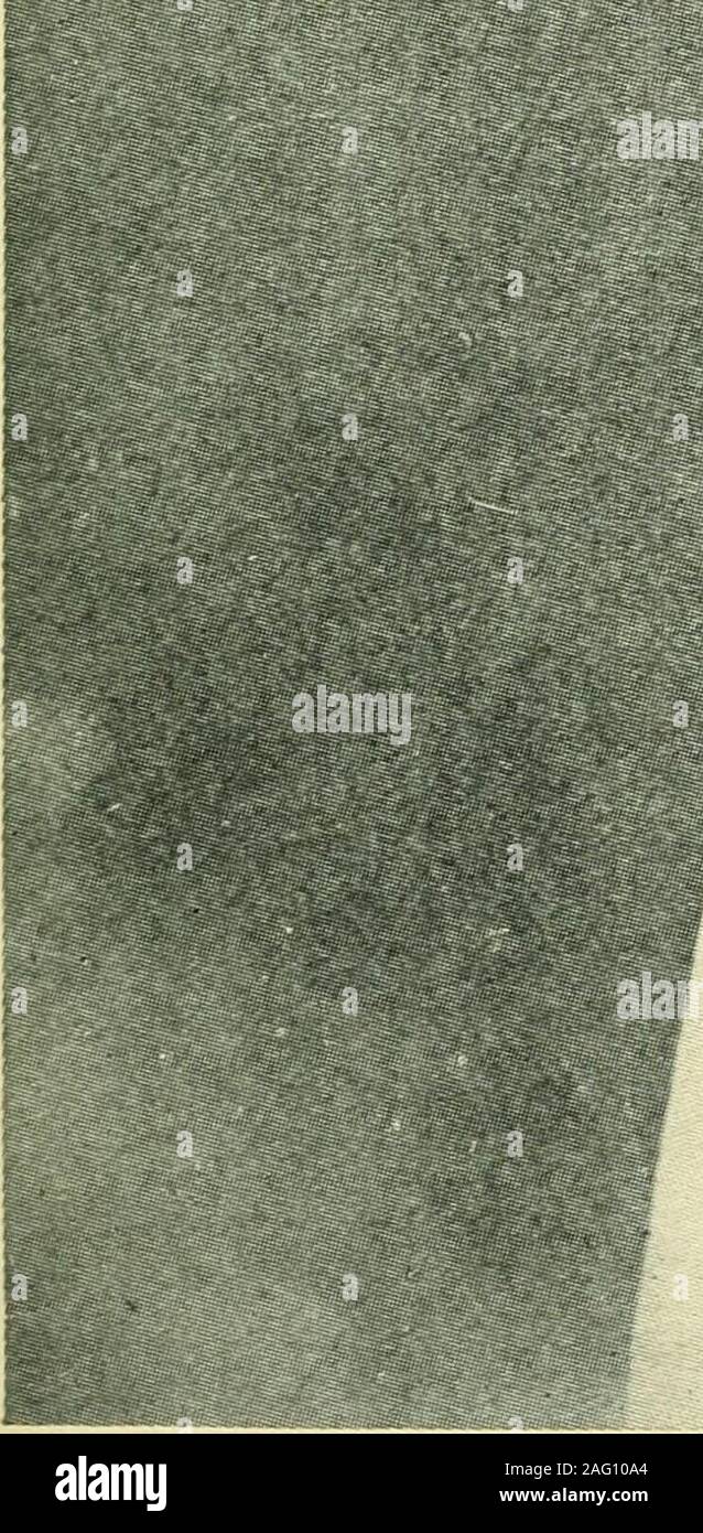 Histoire Des Soins Infirmiers Banque D Image Et Photos Alamy