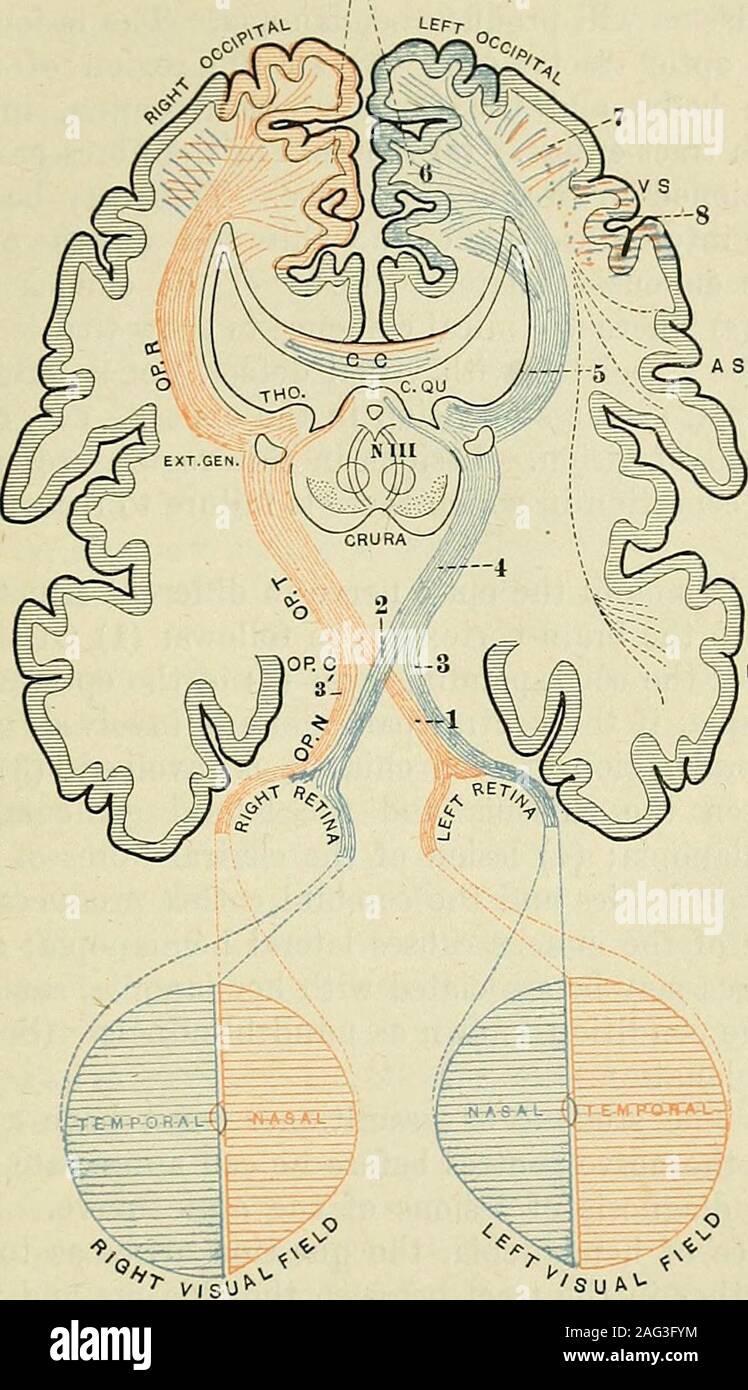 . Les principes et la pratique de la médecine, conçues pour l'usage des praticiens et des étudiants de médecine. e hémianopsie nasale peuvent se produire à la mani-festation de tabes et dans les tumeurs impliquant les fibres extérieures de chaque site. (4) Affections des voies respiratoires et de centres. L'appareil optique traverse la crus (pédoncule cérébral) pour l'empêcher de l'outilde l'optique thalamus et se divise en deux parties, l'lesécrous (racine) va à la pulvinar du thalamus, le geniculatebody, et à la partie antérieure du corps (quadrigeminal colliculus supérieur). Fromthese, pièces dans lesquelles la racine latérale se termine, Banque D'Images