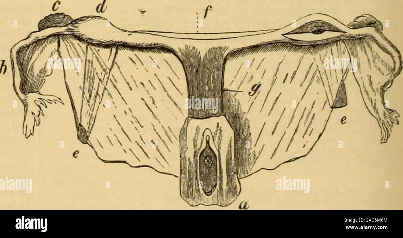 . Un guide de référence des sciences médicales : englobant toute la gamme des connaissances scientifiques et pratiques de la médecine et des sciences connexes. Fig. 4333.-solide, en forme d'arc d'un rudiment de l'utérus.(après Nega.) a. L'utérus en forme de ruban rudi-ment ; 6, ft, les ligaments ronds ; c, c. : d'oviductes, il.des ovaires. Fig. 4336.-Rudimentarius utérus Bipartitus ou Bicornis. (Après Rokitansky )a. Vagin ; 6, tubes ; c, ovaires : d, élargissement de la corne : e, ligament rond ;/. point d'union des deux cornes ; g. tissus cellulaires traversées par le muscle-fiberswhich simuler l'utérus en forme. indiscernable de remplir absen Banque D'Images