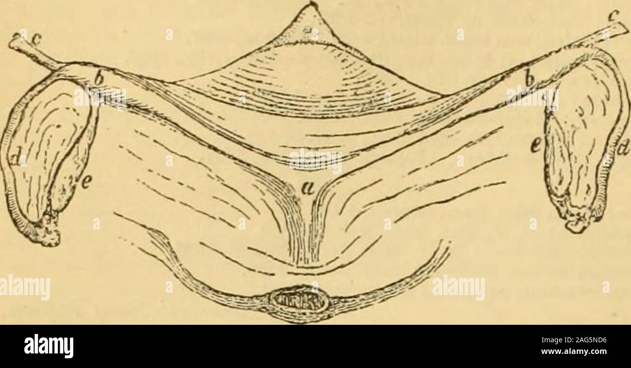 . Un guide de référence des sciences médicales : englobant toute la gamme des connaissances scientifiques et pratiques de la médecine et des sciences connexes. n a rencontré rarement dans des sujets, par nomeans est rare dans les monstruosités incapable de vie.Chaque fois que rencontrés, d'autres signes d'une grave blowto le progrès du développement sont presque toujours une partie la présence de l'appareil génital. L'individu, dans la voix, l'habitude, et de conformation générale adhère à thefemale type, mais les organes qui caractérisent le womanmay, seuls ou en combinaison, être tout à fait à la hauteur, ou elsemay la pièce toutes les qualités de rudimen Banque D'Images