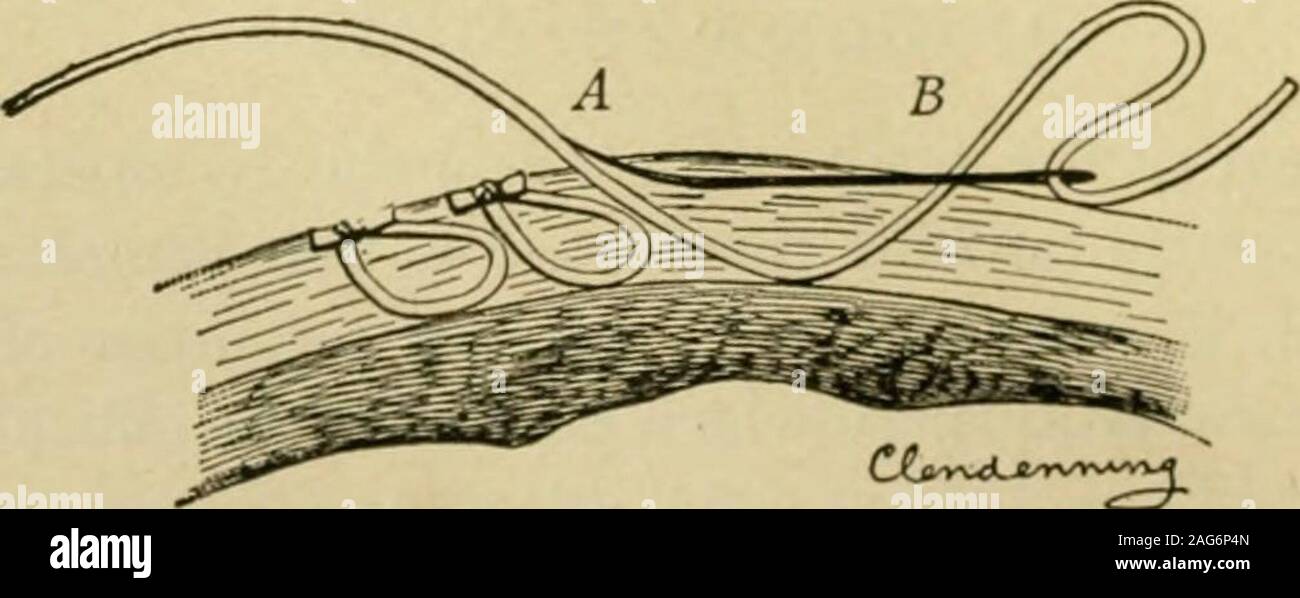 . Dispositif manuel de chirurgie. Je VWVA^^ fc Fig. 2.opération