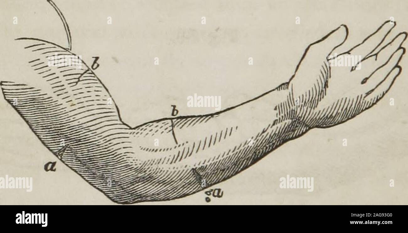 . Un traité sur l'anatomie, la physiologie et l'hygiène : conçu pour les établissements, les académies, et les familles. ela la plupart des maladies dangereuses. 385. Les blessures causées par la morsure d'animaux enragés ou ven-omous serpents, devraient être immédiatement nettoyé avec pure ce qu'il faut éviter ? Comment les bandes de plâtre être removedfrom une plaie Comment est l'union des parties divisées effectuée ? 384. Howshould perforé et plaies déchiquetées être habillé ? 385. Qu'est-ce thetreatment de blessures causées par la morsure d'animaux enragés ? 180 l'anatomie, la physiologie et l'hygiène. l'eau. Dans de nombreux cas, l'application de la succion, eith Banque D'Images