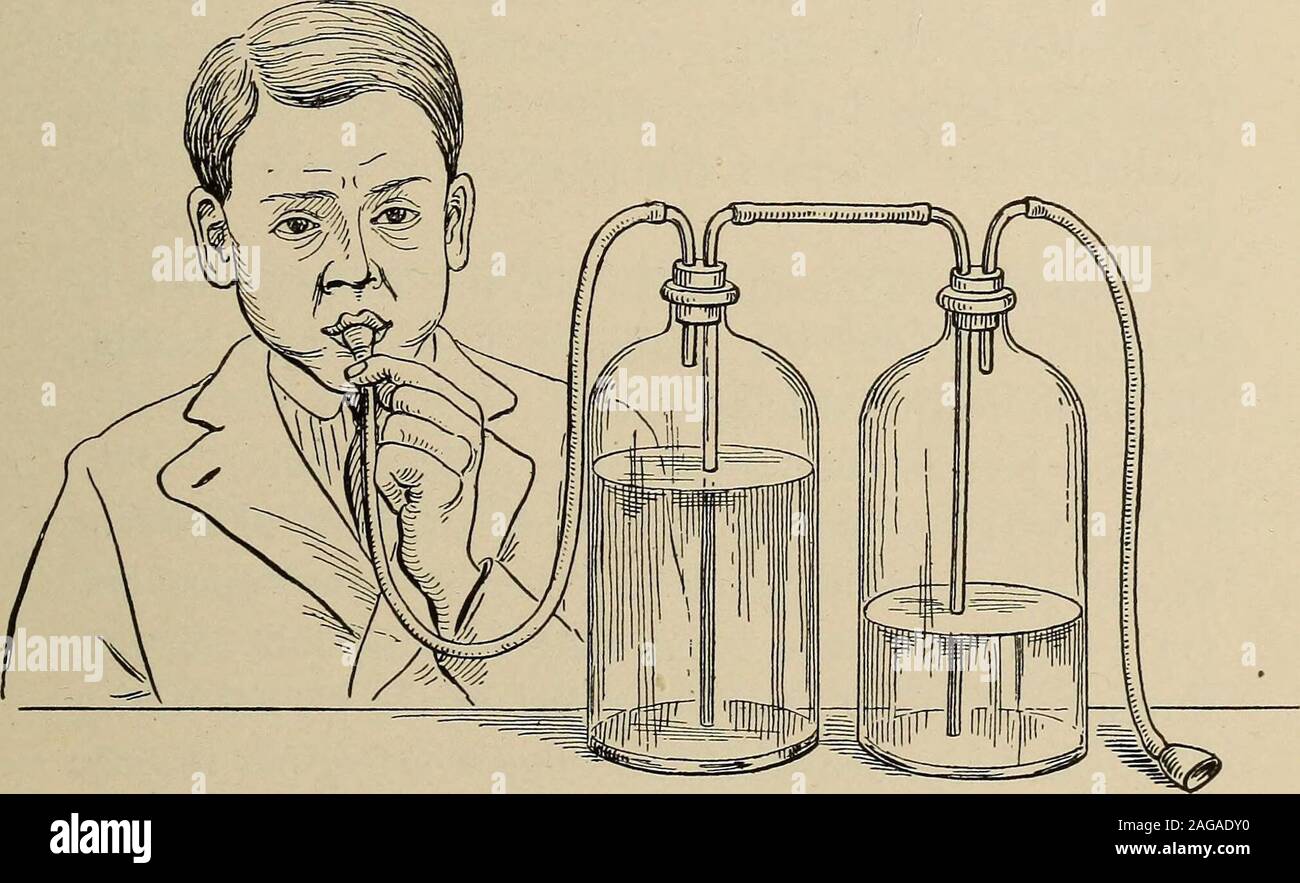 . Maladies de l'enfance. Fig. 25.-Appareil pour l'aspiration (Kerley). aiguille a pénétré trop loin et fait completelythrough la cavité. Soins et piqûres répétées willusually surmonter cette éventualité. Le traitement. Après qu'il a été définitivement décidé que l'affaire est l'un de l'empyème Il existe deux procedureswhich le médecin peut suivre. Dans le grand nombre DES VOIES RESPIRATOIRES 87 d'affaires qu'il aura l'enfant opérée. Dans afewer nombre de cas qu'il aura l'cavityaspirated pleural. Opération.-cela consiste en l'ouverture de la cavité pleurale, supprimer le pus, et la vidange. E Banque D'Images