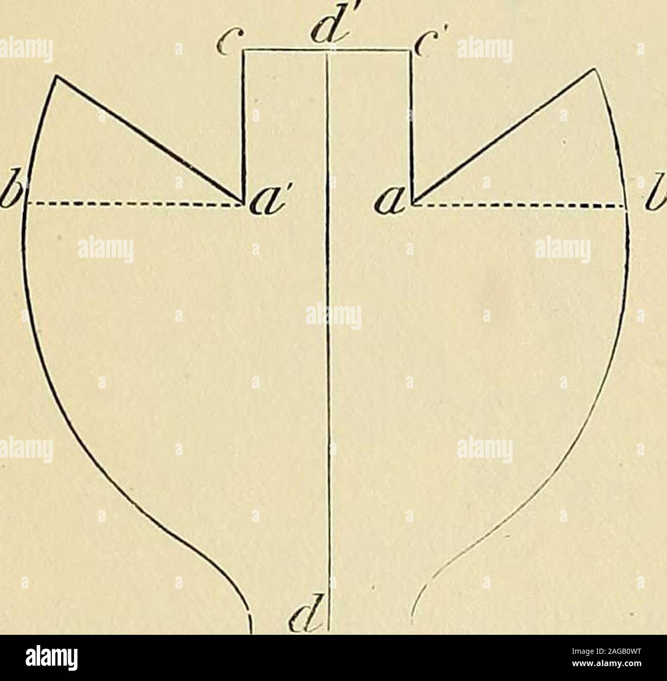 . Chirurgie du dispositif. e avec l'ennui qu'elles causent. Sup-port vitalisée est souvent obtenue par l'intermédiaire de deux petits skinflaps {longitudinal a I) tourné vers l'intérieur des frontières de l'écart et placés avec theraw vers l'extérieur des surfaces, ce qui permet de soutenir le principal volet (c) (Fig. 732) (Thiersch). Morceau d'os takenfrom chaque côté de l'os aperturewith une amende vu et soulevée vers le haut de manière toform soutenant un arc pour le partswas Langenheck doux conseillé par (Fig. 733, 1, a et h). Le pédicule est divisé usuallyat la fin de la quatrième semaine, et partie theattached est utilisée pour Banque D'Images
