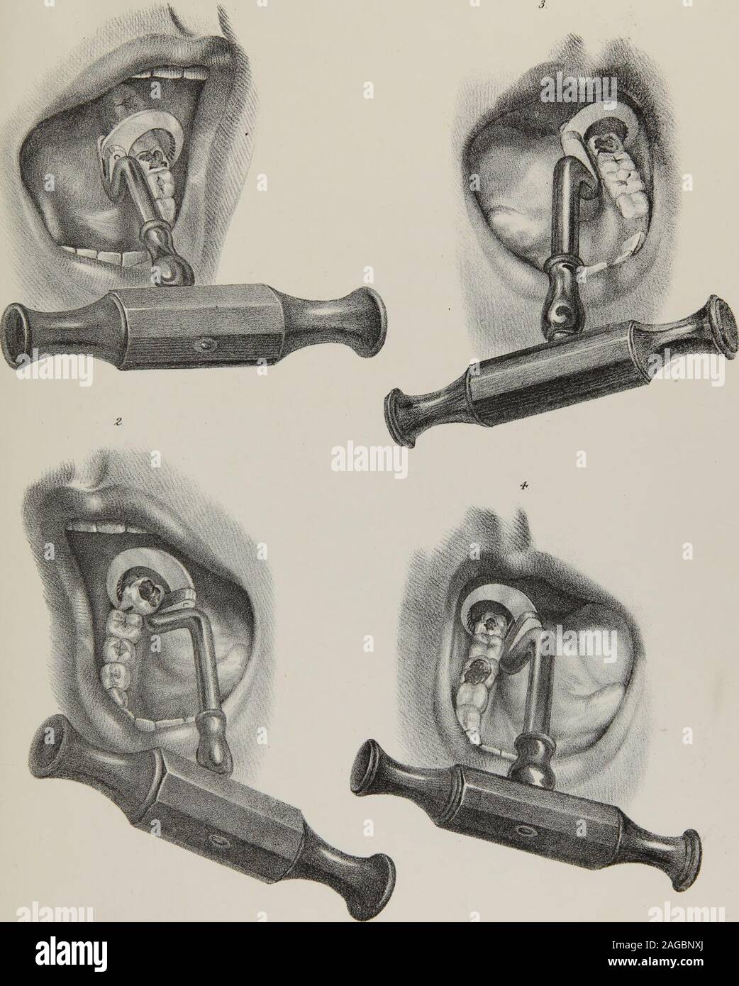 . L'anatomie, physiologie et pathologie des dents : avec les la plupart des méthodes de traitement approuvées : y compris les opérations, et la méthode de réglage et les dents artificielles, avec trente plaques. L, (trijumeau.) 1. Racine du nerf. 2. Ganglion de casser. 3. Première branche, nerf ophtalmique. 4. Deuxième branche du nerf maxillaire supérieur, supérieur. 5. Troisième branche, nerf maxillaire supérieur inférieur. 6. Nerf frontal. 7. Nerf lacrymal. 8. Nerf nasal. 9. Direction générale de l'os malaire. 10. Infra-orbitaire nerf. 11. Nerfs dentaires postérieurs à molares. 12. Nerfs dentaire antérieure à l'avant des dents. 13. Branches de terminaison de l'infrarouge Banque D'Images