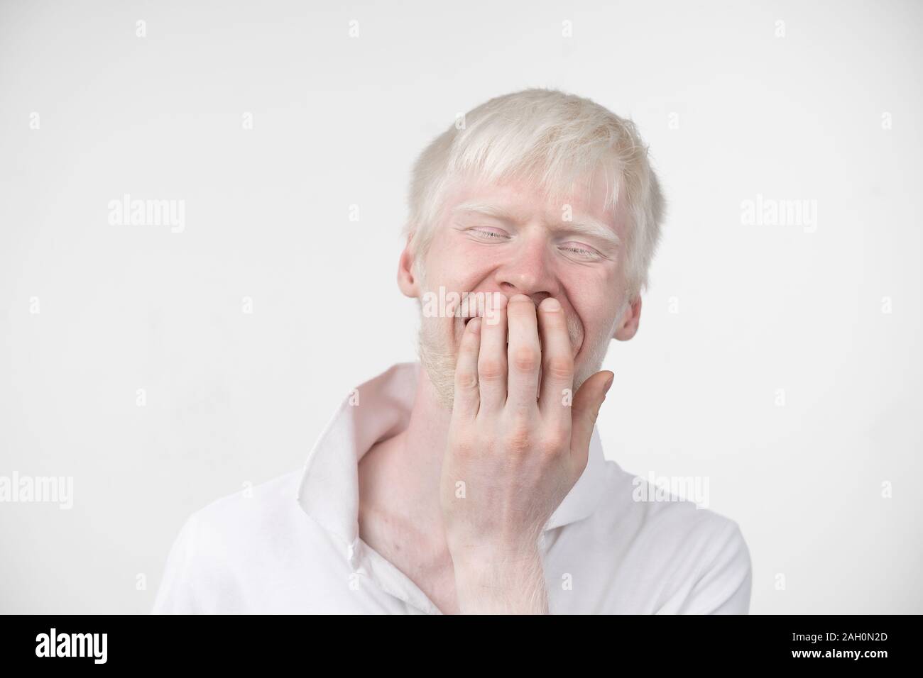 Portrait d'un homme albinos dans studio habillé t-shirt isolé sur un fond blanc. déviations anormales. Aspect insolite anomalie de la peau. Banque D'Images