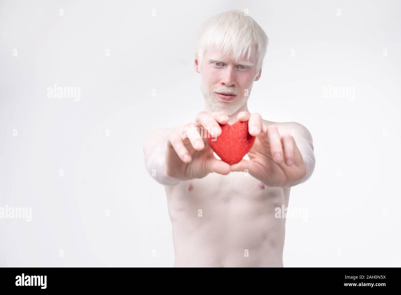 Portrait d'un homme albinos dans studio habillé t-shirt isolé sur un fond blanc. déviations anormales. Aspect insolite anomalie de la peau. Banque D'Images