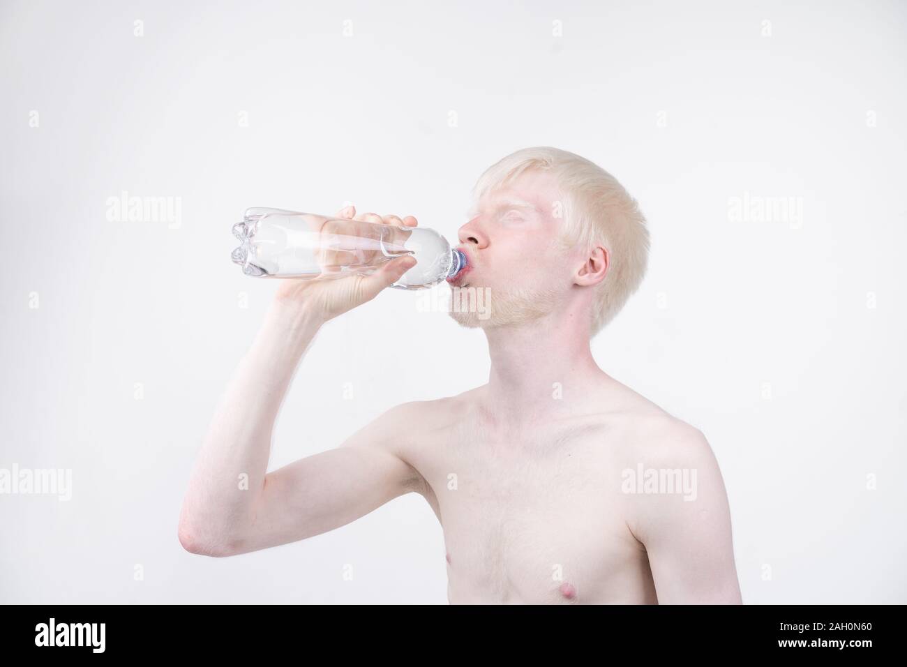 Portrait d'un homme albinos dans studio habillé t-shirt isolé sur un fond blanc. déviations anormales. Aspect insolite anomalie de la peau. Banque D'Images