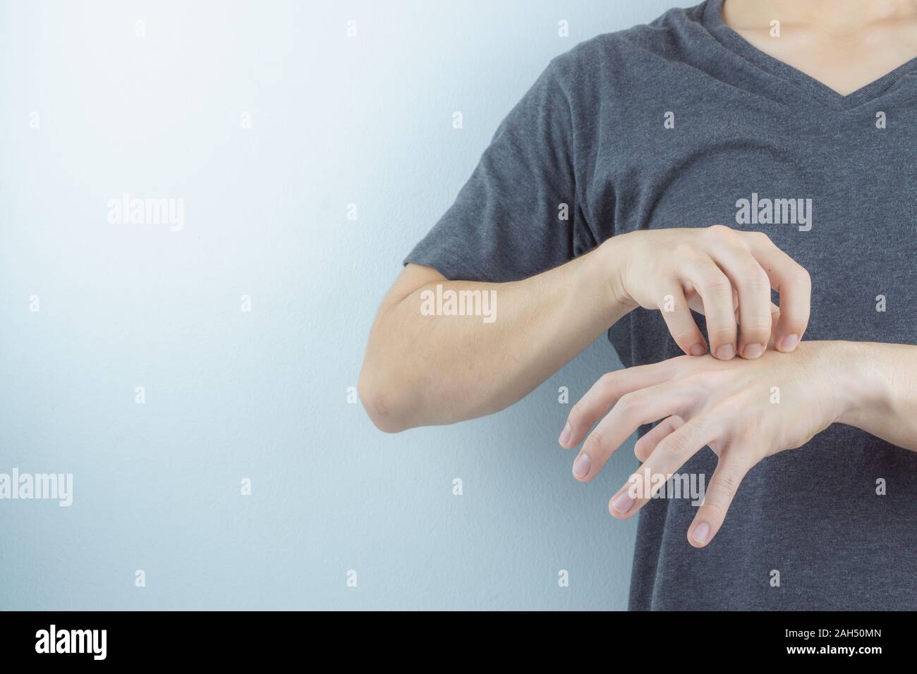 Close up man se gratte la main avec éruption prurigineuse allergie à la main sur fond blanc. Problème de peau, de soins médicaux et de concept. Banque D'Images Close up man se gratte la main avec éruption prurigineuse allergie à la main sur fond blanc. Problème de peau, de soins médicaux et de concept. Banque D'Images