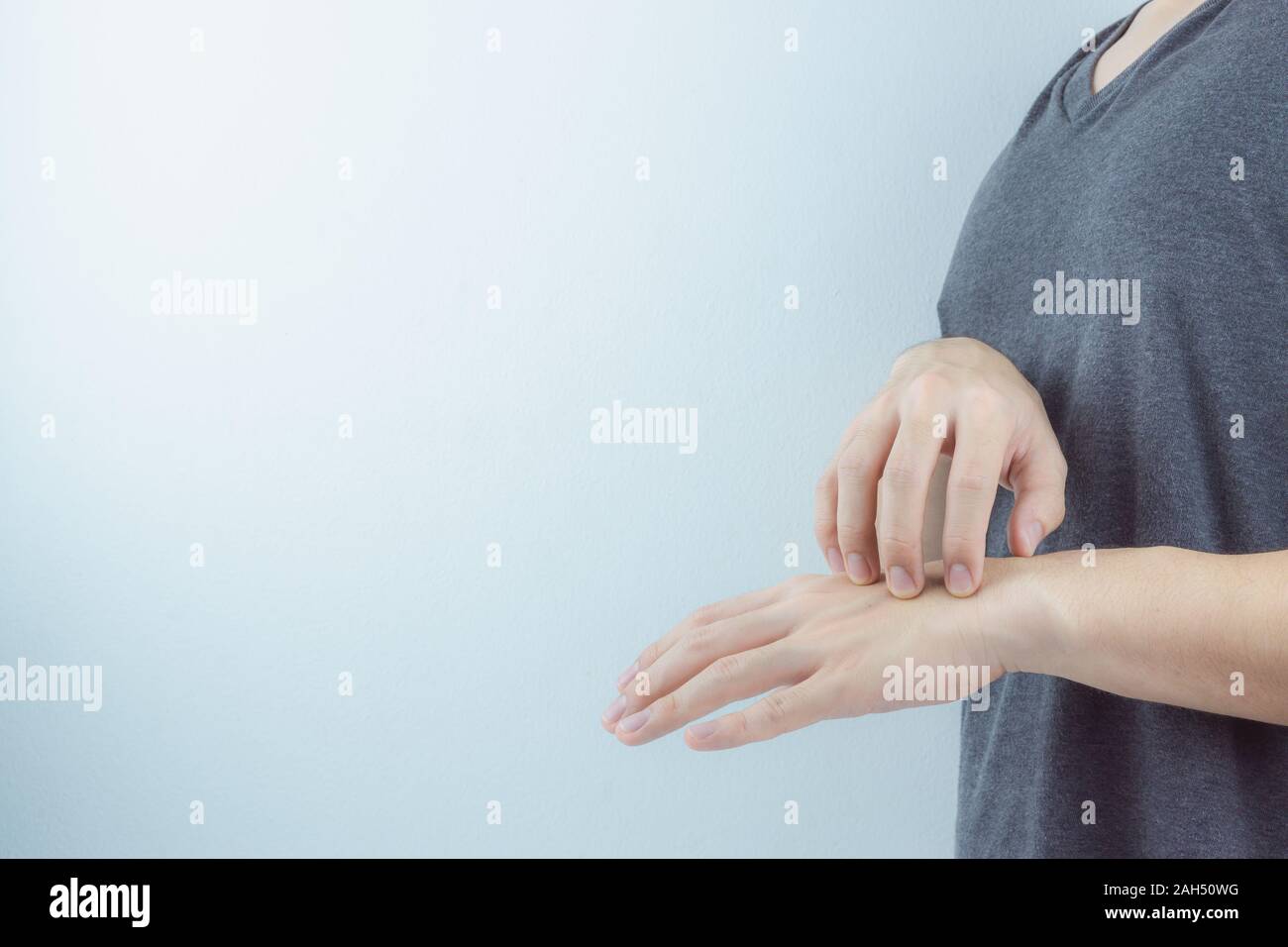 Close up man se gratte la main avec éruption prurigineuse allergie à la main sur fond blanc. Problème de peau, de soins médicaux et de concept. Banque D'Images Close up man se gratte la main avec éruption prurigineuse allergie à la main sur fond blanc. Problème de peau, de soins médicaux et de concept. Banque D'Images