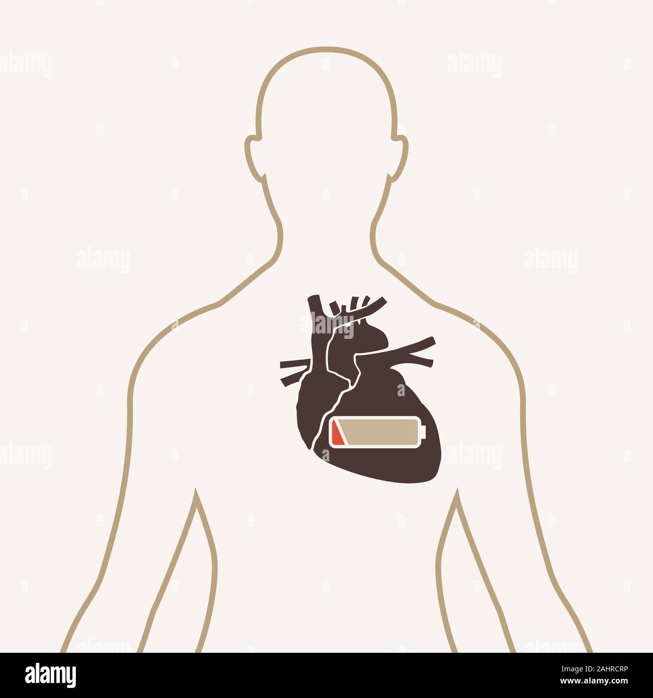 Le syndrome d'épuisement professionnel logo icône vector Illustration de Vecteur