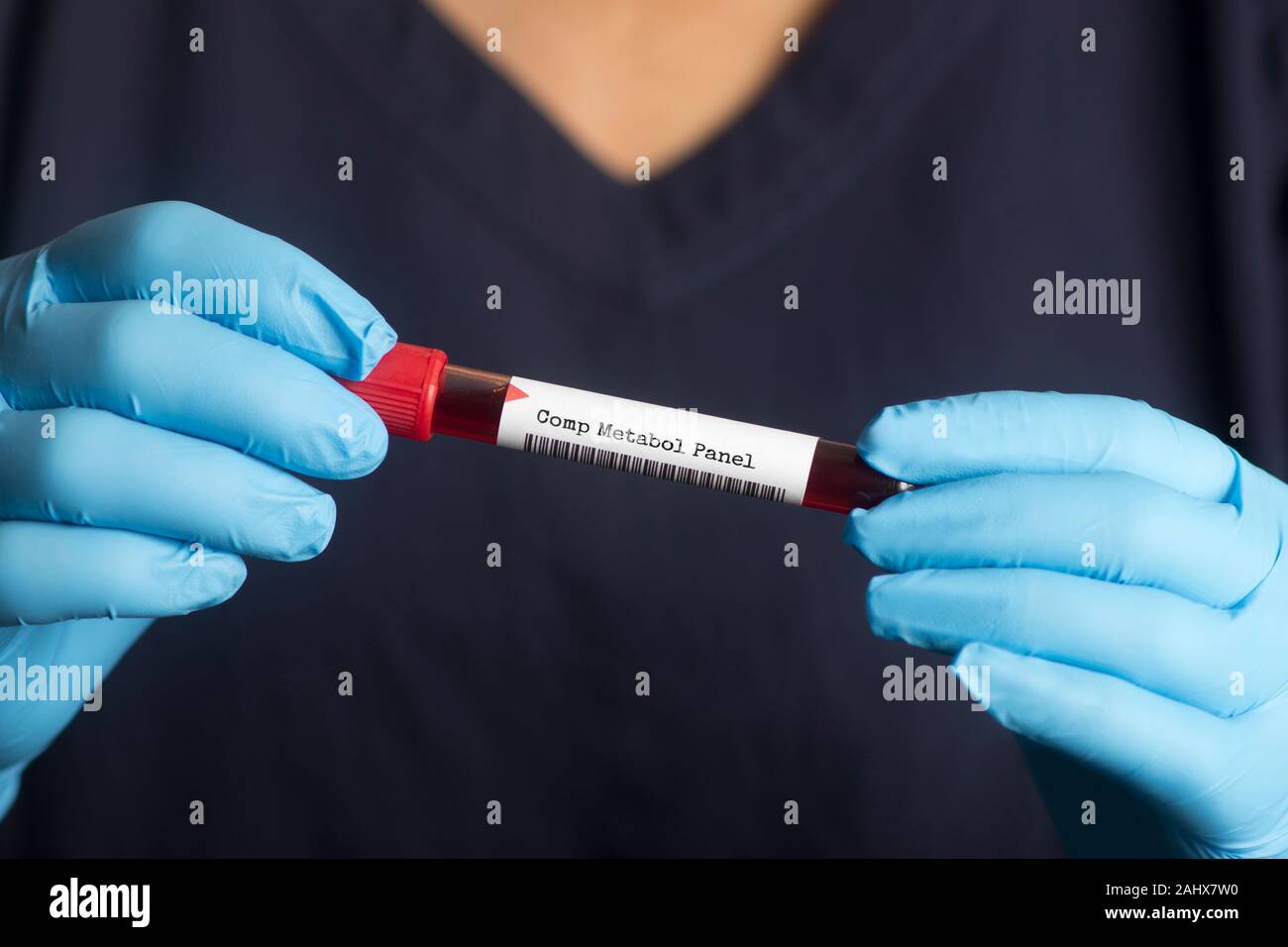 Panneau métabolique global. Un test sanguin de CMP est un panel de 14 tests utilisés pour surveiller la fonction hépatique et rénale, les niveaux d'électrolytes et de la glycémie Banque D'Images
