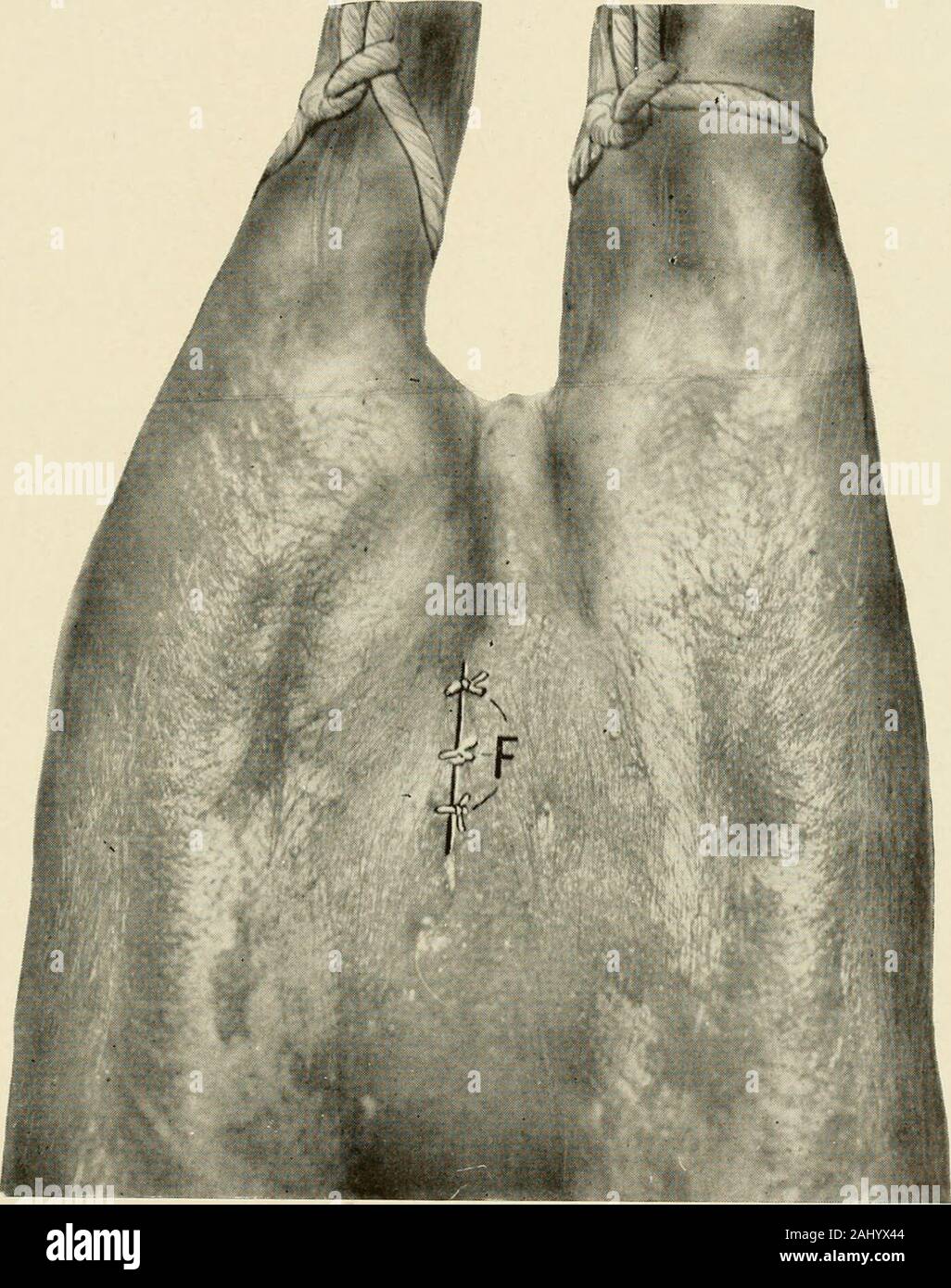 La castration des animaux : un livre à l'usage des étudiants et praticiens . ow l'incision abdominale,auquel cas le cordon est situé et attiré dans abdominalincision et la conséquence naturelle est que le testicule va suivre. Le cordon spermatique est maintenant rompu et son moignon replacedin la cavité abdominale. Si un étalon (un-deux testicules descendus) les deux testicules doivent être enlevés par l'un ab-dominal incision. La paroi abdominale devrait maintenant être fermé withthree points séparés. Ces sutures doivent être ce qu'est le knownas à travers et à travers toutes les couches de variété-le abdominalwa Banque D'Images