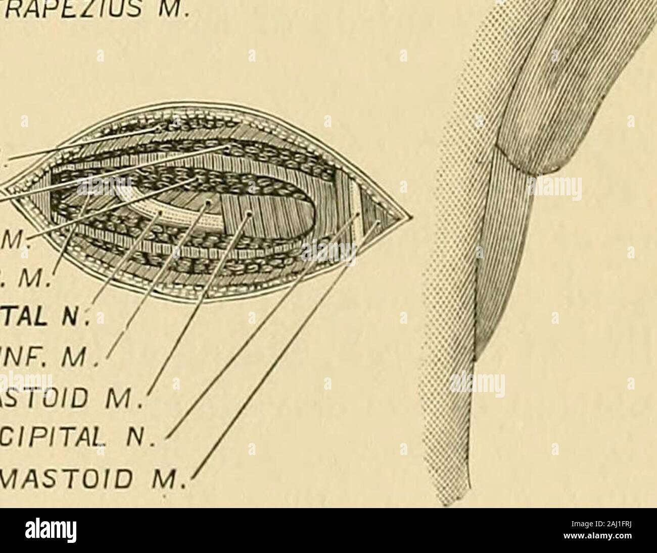 Wo entspringt der tanger ? 2 chirurgie du dispositif le trapezius msplenius mobliquus plexus com m capitis capitis sup m gre n nobuquus occipitale capitis inf a f trachelo mastoide m petite nsternomastoid occipitale m fig 231 occipitale et de l artere occipitale grand nerf l os occipital elle passe ensuite sur la partie posterieure de l skullmidway entre la protuberance occipitale externe et de l apophyse mastoide 202 cooperatives d une chirurgie fig 214 e il n a pas d hony intime ou musculaires guide il est lie a l itsorigin et derriere l apophyse mastoide l operation a l origine fig 216 faites une incision le long theanterior bor 2aj1frj