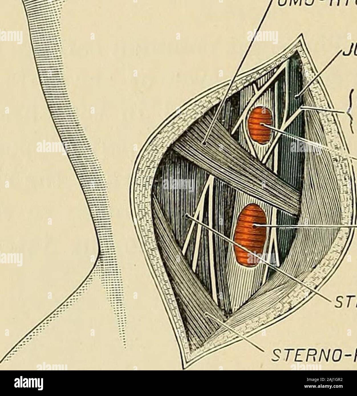 La chirurgie opératoire . erve. ( ^^^^^^ ) artère thyroïdienne inférieure. Larynx.pharynx. • Derrière. Longus colli. Sympathique. Le Rectus capitis anticus major. L'artère thyroïdienne inférieure. Nerf laryngé récurrent. Le guidage linéaire pour le navire est une ligne tracée entre le sterno-claviculararticulation à mi-chemin entre l'angle de la mâchoire et l'apophyse mastoïde. Le guide de la musculaire : inutile7i est le bord antérieur du sterno-cleido-mastoïdien. musculaire. 192 chirurgie opératoire. Chaque navire peut être ligatured dans trois situations : 1, à l'origine de ducou ; 2, juste en dessous du muscle omo-arc hyoïdien ; 3, ci-dessus que mus Banque D'Images