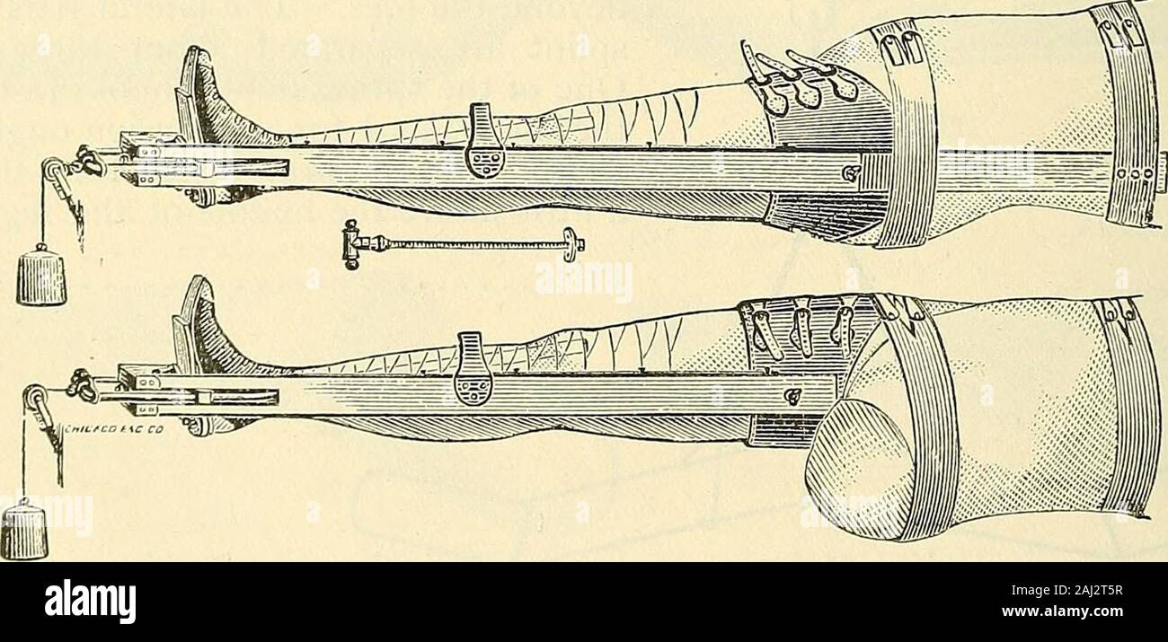 Catalogue de Sharp & Smith : importateurs, fabricants, grossistes et détaillants dans les instruments chirurgicaux, appareils difformité, membres artificiels, yeux artificiels, bas élastiques, treillis, de béquilles, de supports, et galvanique faradic batteries, etc., les appareils des chirurgiens de toutes sortes . Fig. 4842-Dr. L'éclisse de Veritys complète. 12 $ 00. Fig- 4843-agrafes Appareil Fracture SHARP & SMITH, Chicago. 787 Matériel d'attelles et d'une attelle. Banque D'Images