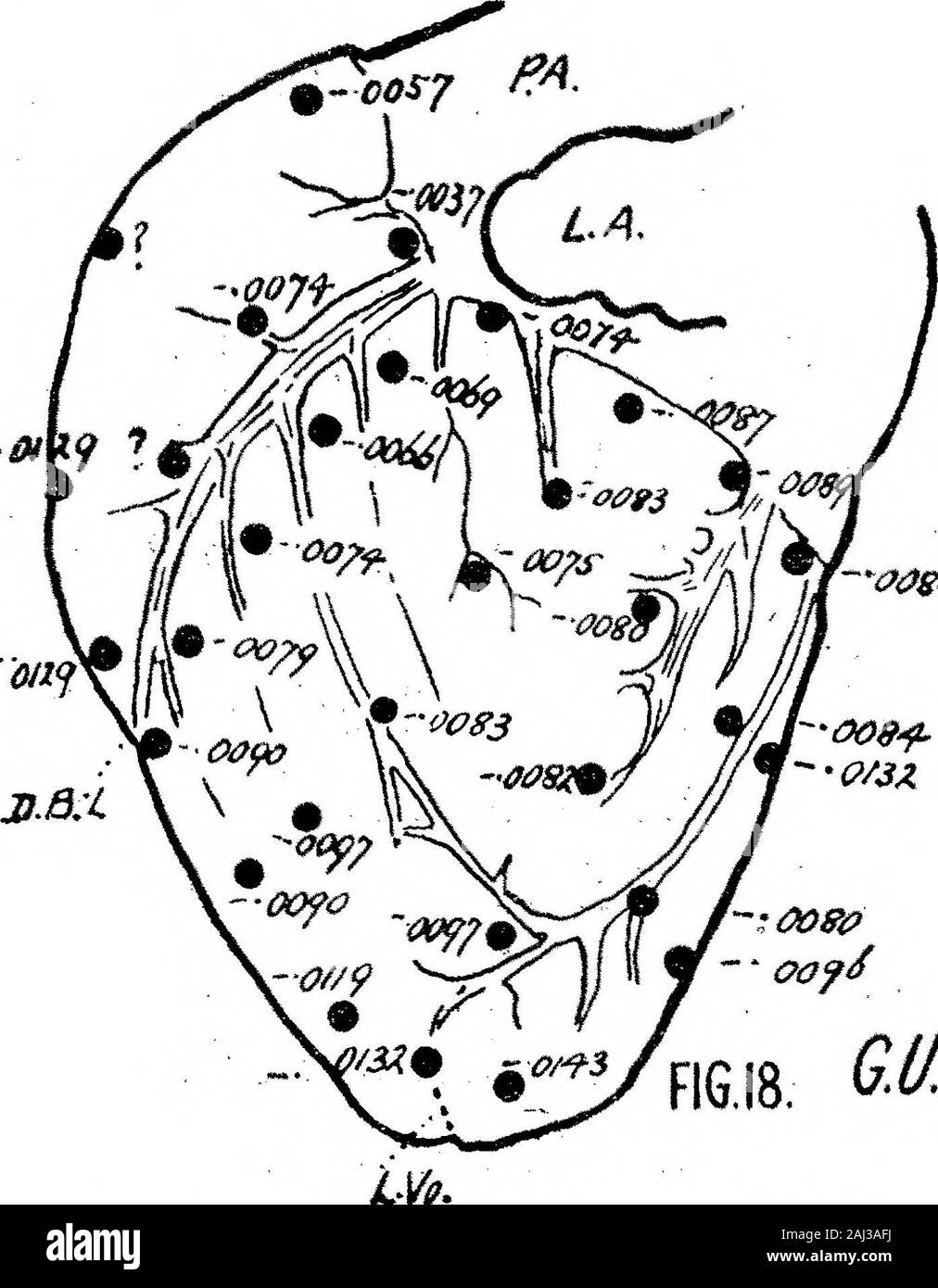 Le processus d'excitation dans le coeur du chien Partie II Les ventricules . -*® 009000& * AASP£ FI6.I8. &Tt Fig. 17 et 18.-La preuve extrinsèque à la déflexion de contacts sur le ventricule droit (Chien G.T.) et au ventricule gauche (G.TL). Les observations sont du même coeur que celles indiquées à la fig. 6 et 9.. w# &Lt ; ?- 218 mm. T. LEWIS ET M, A. ROTHSCHILD SUR LA TABLE XVII.-Dog G.L. Iable XVII.-Dog G.M. Tableau XVIII.-Dog G.W. Contact. Extrinsèque. Intrinsèques. ^ ? 1] 2 345 67 89 22 101112131415161718192021 j^L.V.232425 0000000000000000000000000 •••0045 0025 0046 0050 0061•••••0076 0059 0038 0078 0059••• Banque D'Images