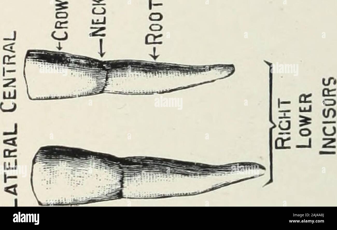 Un atlas des extractions dentaires avec des notes sur les causes et le soulagement de la douleur dentaire : conçues pour l'usage des étudiants en médecine et les praticiens . o3 Banque D'Images