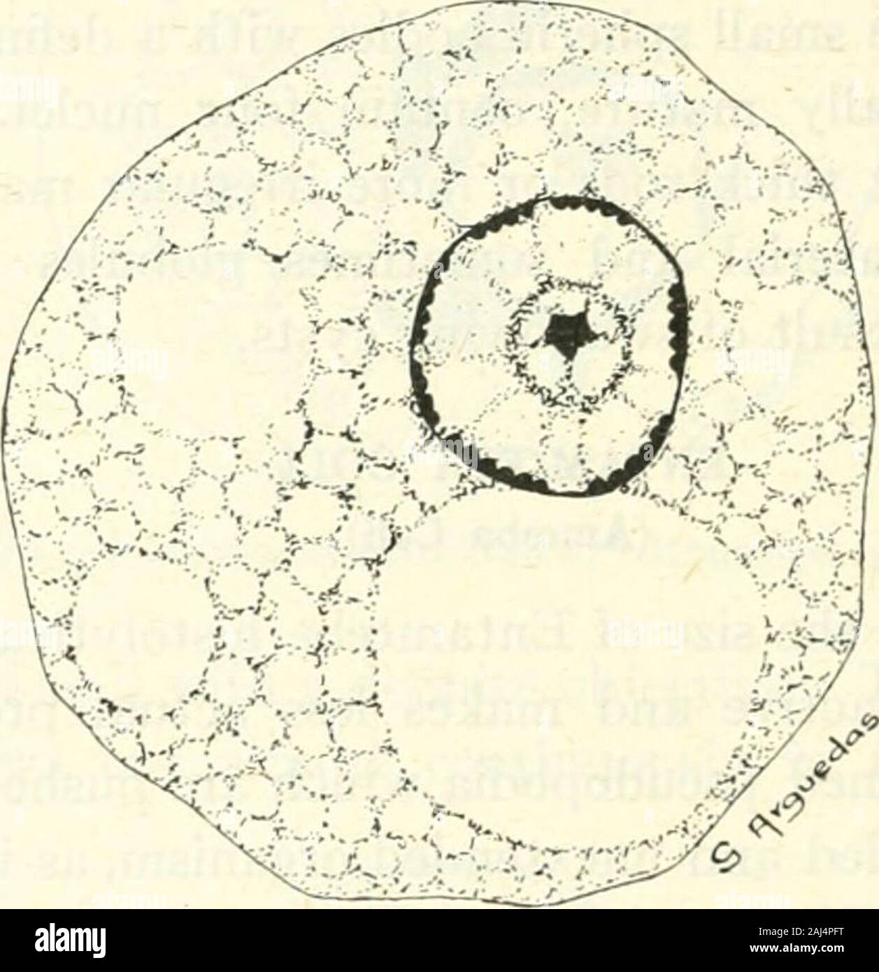 La Medical Clinics of North America . n ceux d'Entamoebahistolytica. Parfois chromidial, plus commonlyin la forme de splinter-comme les bars, sont présents. En deux ans d'expérience par l'un d'entre nous à l'IHE Hospitalin Yale Province Yunan en Chine centrale amibiase dysentérique wasfound d'être plus commun. Le cas suivant est typique ofhundreds et illustre la façon habituelle d'infectionwith intestinal Entamoeba histolytica dans un climat chaud. 4io ALFRED C ; REED, Harry A. WYCKOFF Cas IX.- bien nourris un garçon chinois de 10 ans wasadmitted au ward avec une histoire de la diarrhée pendant quatre mois Banque D'Images