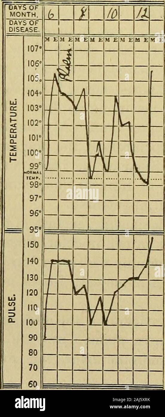Les rapports médicaux et chirurgicaux . sh avec matière mucoïde extrêmement fluide et granulaire des sédiments. 166 maladies contractées dans la campagne cubaine. Les reins, le poids, 355 grammes. Capsule pèle facilement ; sur sectioncortex, pâle ; relations entre cortex et pyramides;normal section frais montre pas de gras. L'aorte, normal. Andtesticles la vessie, de la prostate normale. La moelle osseuse, de couleur rouge foncé, de l'entreprise. Notopened la tête. À partir de frottis pleurae et poumons montrent une variété d'organismes, parmi lesquels la dii^lococcus lancéolées. Diagnostic anatomique : la pneumonie lobaire aiguë ; bronchopneumonie aiguë abcès du poumon ; ; fibrineuse aiguë Banque D'Images