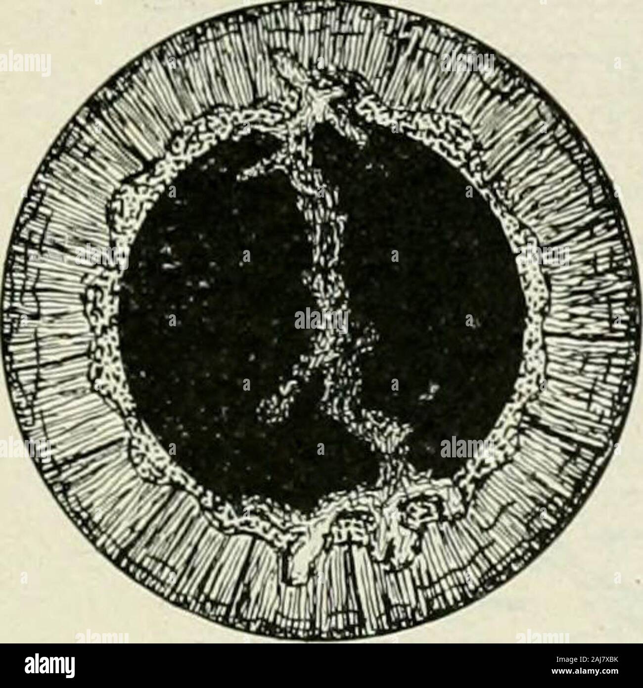 Le roturier maladies de l'oeil : comment détecter et comment les traiter . tion folloziing la dépose de la Gas-serian ganglion. Parésie dans de la septième,nerveux lorsqu'il n'y a lagophthalmus isunable et le patient de fermer l'œil en raison de manque du muscle orbiculaire, marqué dans l'ectropion andafter une perte d'une partie de l'practicallythe couvercles même forme d'infection de la cornée peut se produire. Le traitement consiste à couvrir l'œil avec eye-ombre où tout ce qui interfère avec theproper la protection de la cornée, et l'instilla-tion de l'huile de ricin ou de la vaseline stérile quatre timesdaily après washi Banque D'Images Le roturier maladies de l'oeil : comment détecter et comment les traiter . tion folloziing la dépose de la Gas-serian ganglion. Parésie dans de la septième,nerveux lorsqu'il n'y a lagophthalmus isunable et le patient de fermer l'œil en raison de manque du muscle orbiculaire, marqué dans l'ectropion andafter une perte d'une partie de l'practicallythe couvercles même forme d'infection de la cornée peut se produire. Le traitement consiste à couvrir l'œil avec eye-ombre où tout ce qui interfère avec theproper la protection de la cornée, et l'instilla-tion de l'huile de ricin ou de la vaseline stérile quatre timesdaily après washi Banque D'Images