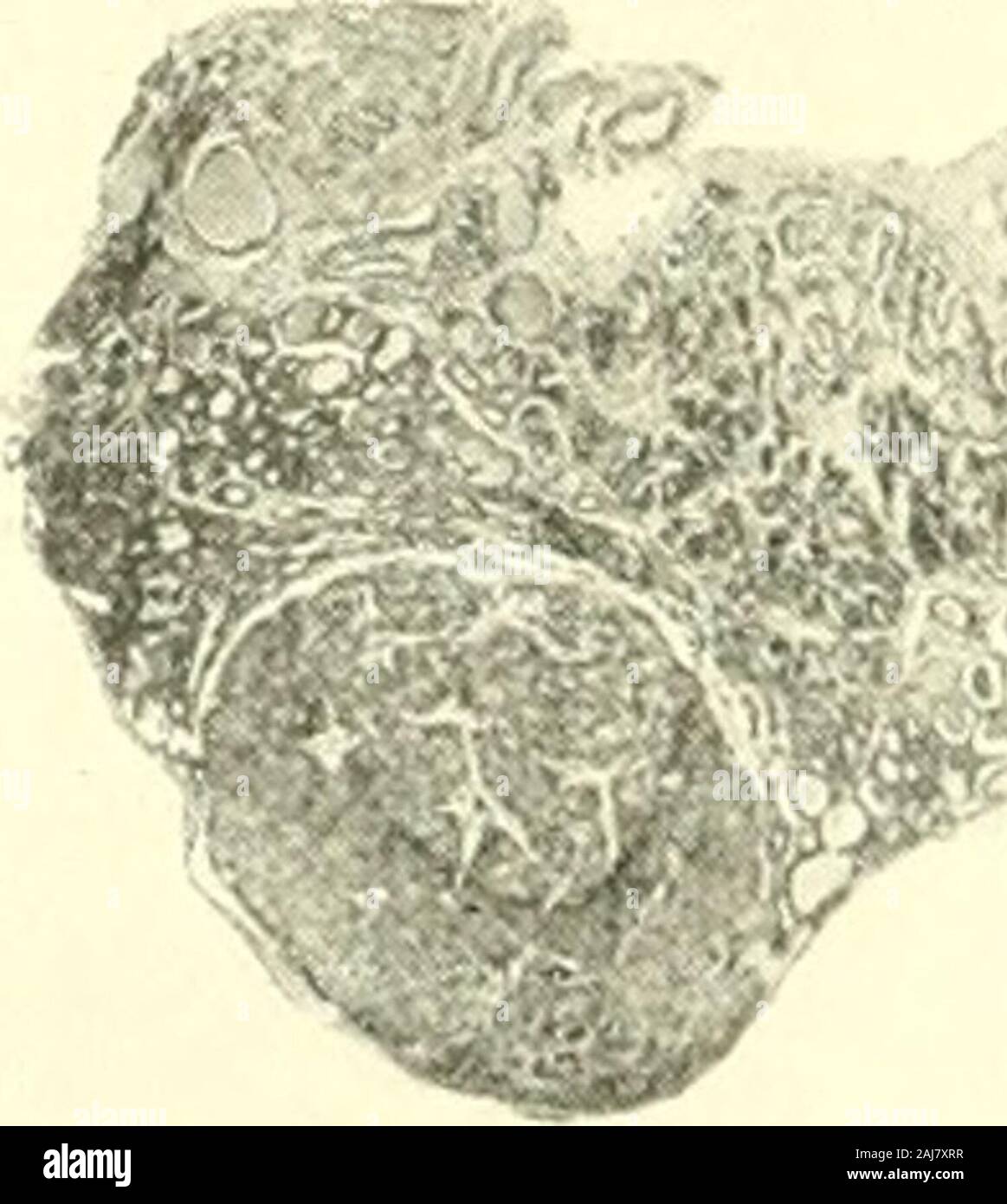 Le journal américain de l'anatomie comparée . J. Fig. 3 à partir d'une photographie d'un lobe de l'tliyroid ghuul nonnal de al-bino rat No S 5.3, l'âge de 74 jours, poids brut-corps 172 grammes. Dans la parathyroïde-conclus. Comparer avec les chiffres 4, 5 et 6, représentant la thyroïde chez les rats de même âge, init tenue à l'entretien à partir de l'âge de 3 semaines. (X 28). Fig. 4 à partir d'une photographie d'un lobe de la glande thyroïde de ratNo albinos. S 11.63, l'âge de 72 jours, poids brut 23,8 grammes-corps (tenue au fromage d'entretien de 3 semaines). Beaucoup plus de follicules à perii)hery. Quelques-capsulaires tis-.sue est iiicliKhd. Relativel parathyroïdienne Banque D'Images