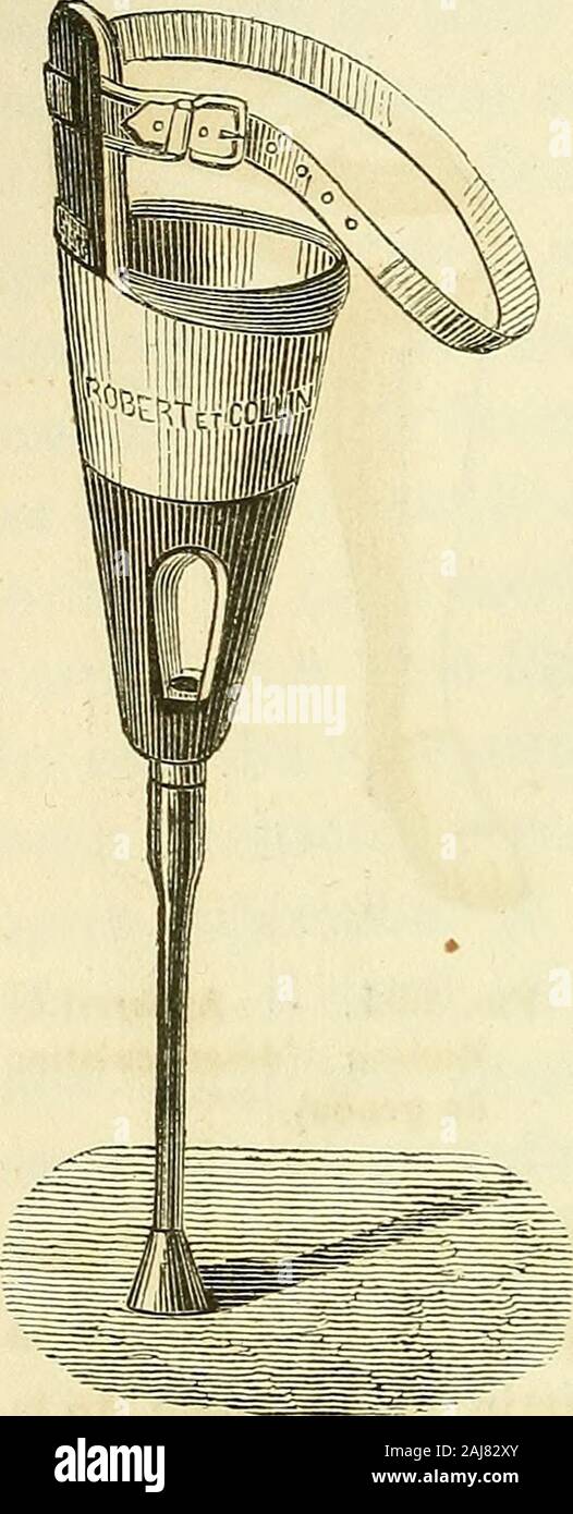 Arsenal de la chirurgie contemporaine : description, mode d'emploi, et appréciation des appareils et instruments internationaux en usage pour le diagnostic et le traitement des maladies chirurgicales, l'orthopédie, la prothése, les opérations simples, générales, spéciales et obstétricales . , Appartenant à laclasse ouvrière, préfèrent le cuissart à pilon, enraison du point dappui solide quil donne à la gare et à la marche, et, surtout, enraison de son extrême simplicité. Ses principaux inconvénientssont les mêmes que ceux de la jambe de bois : tiraillements douloureuxsur le bassin par la ceinture abdomina Banque D'Images
