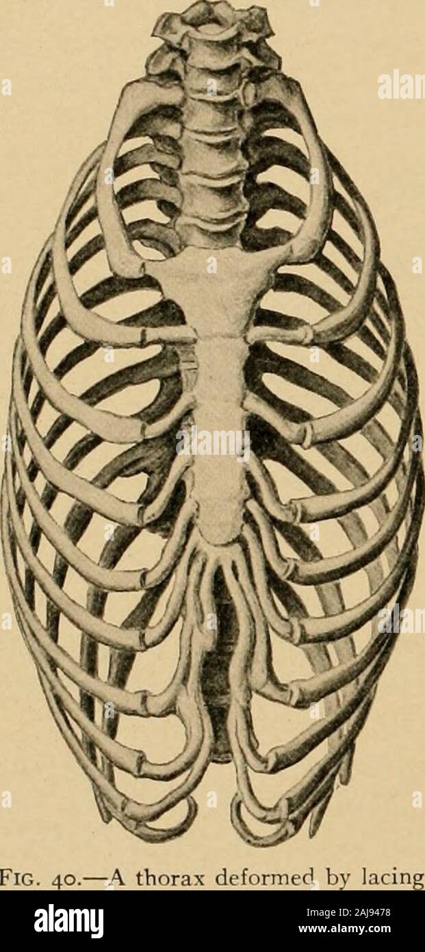 Texte et Atlas-livre de l'anatomie topographique et appliquée de marge supérieur . la première vertèbre dorsale. La relative courte-ness du diamètre sagittal de cette ouverture doit être wellborne à l'esprit. L'ouverture inférieure du thorax est muchlarger ; ses limites sont formées par le processus xiphoïde d thesternum, par le rebord costal, par les extrémités libres des onzième et douzième côtes, et par l'bodyof la douzième vertèbre dorsale. L'ouverture inférieure, contrairement à la catégorie supérieure, se trouve dans deux planeswhich forme un angle, le sommet étant à la baisse, à la partie la plus basse de le rebord costal. La partie osseuse tho Banque D'Images