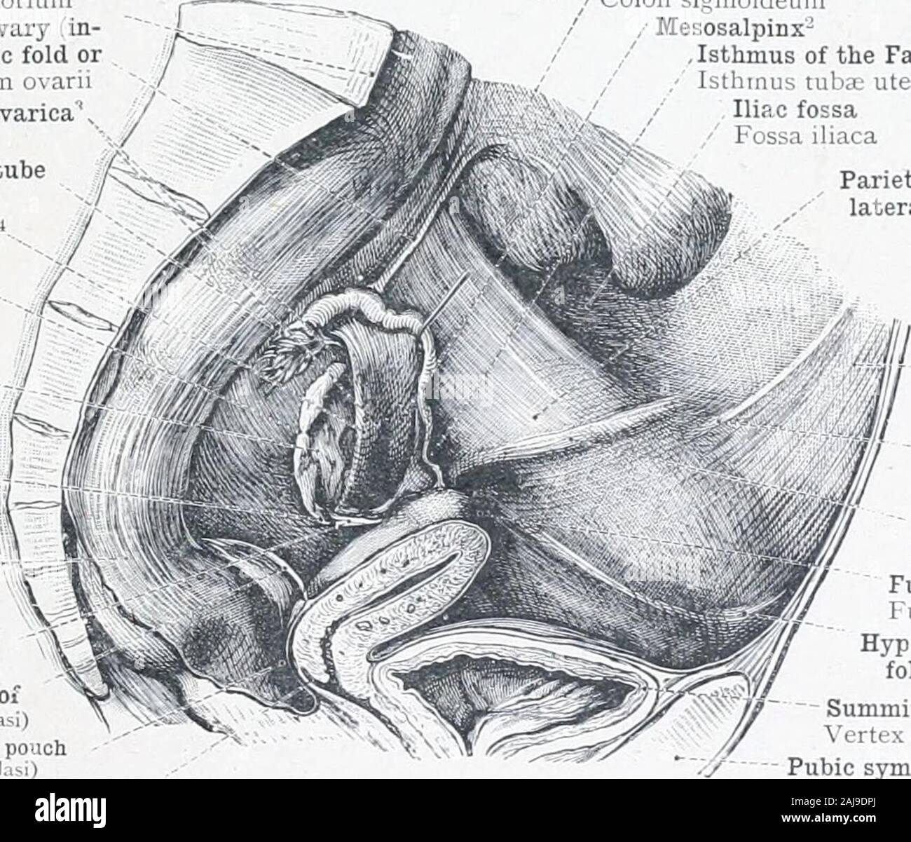 Un atlas de l'anatomie humaine pour les étudiants et les médecins . cahs transversa ou l'ouraque Plica pli ombilical médian•spineof umbilicalis antérieure et supérieure des médias de l'ilion Spina ilutL anteriorsuperior.je trompe 1 uba uterina (Falloppii^- Mésosalpinx) , JE ligament large de l'utérus Mésométrium- J;Frv latum amentum Uterovesical lixeavatio utérus pochette ves.eo-iiterina Corps de l'utérus (ou antérieure) surface vésicale Corpus utérin (faciès vesicalis) bladderesica urinaire Fig. urinaria 929.-viscères pelviens ok une femelle âgée de neuf cent vingt-ans, vu de dessus et de l'avant. PromontoryIrom sacré Banque D'Images