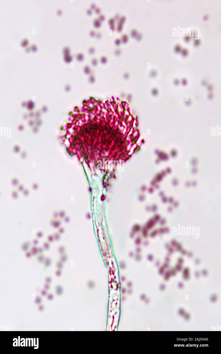 Aspergillus fumigatus Banque D'Images