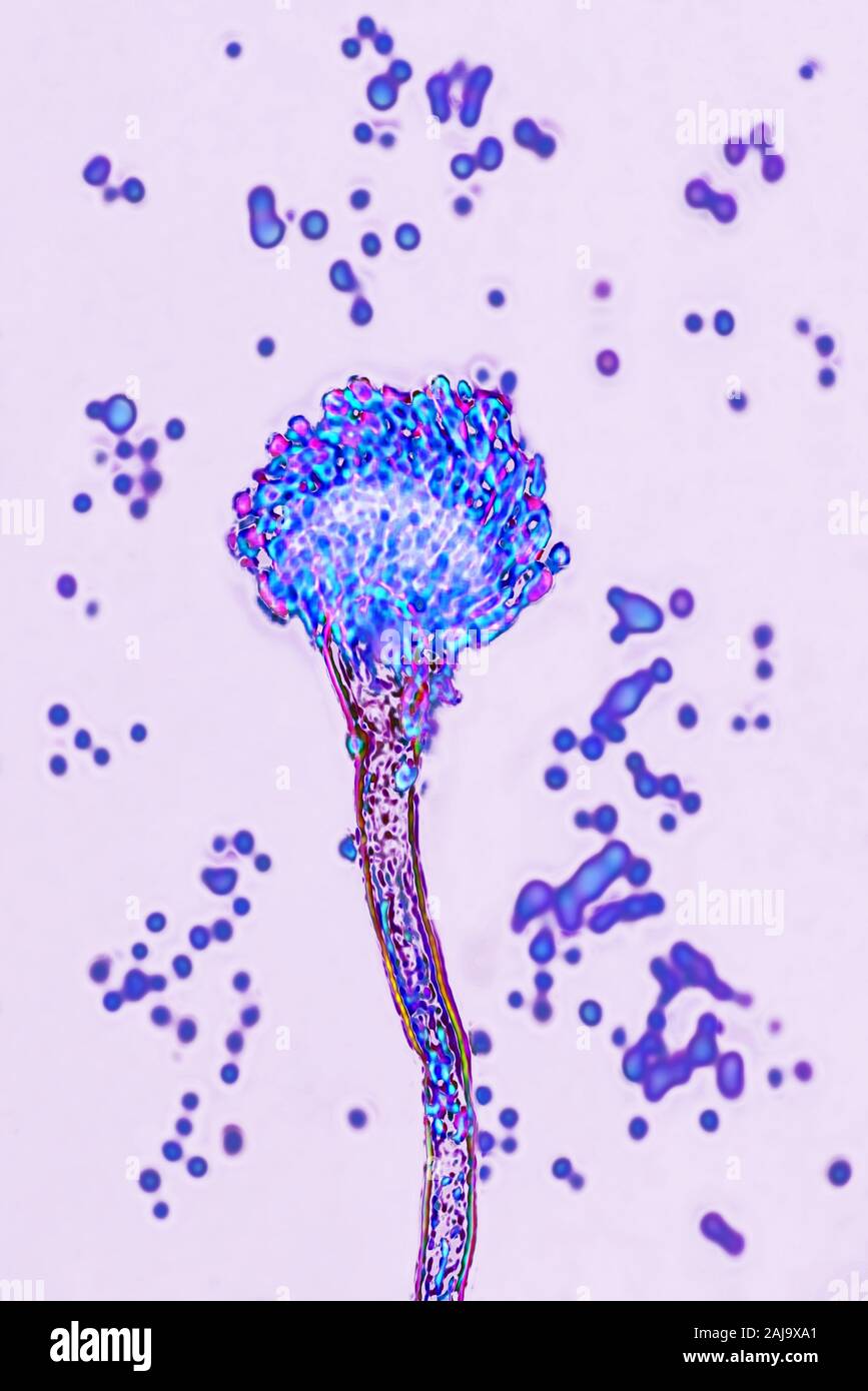 Aspergillus fumigatus Banque D'Images