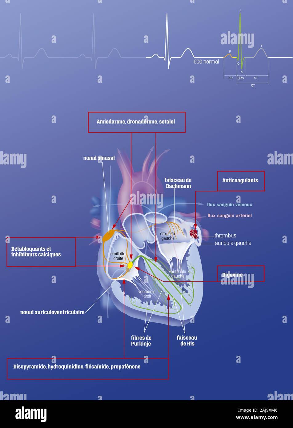 La fibrillation auriculaire et les traitements Banque D'Images