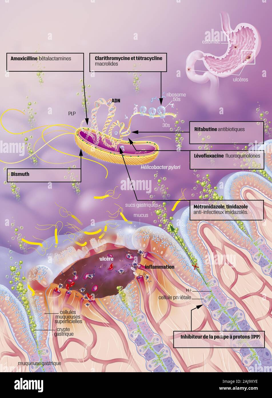 Ulcere et traitement gastroduodénale Banque D'Images