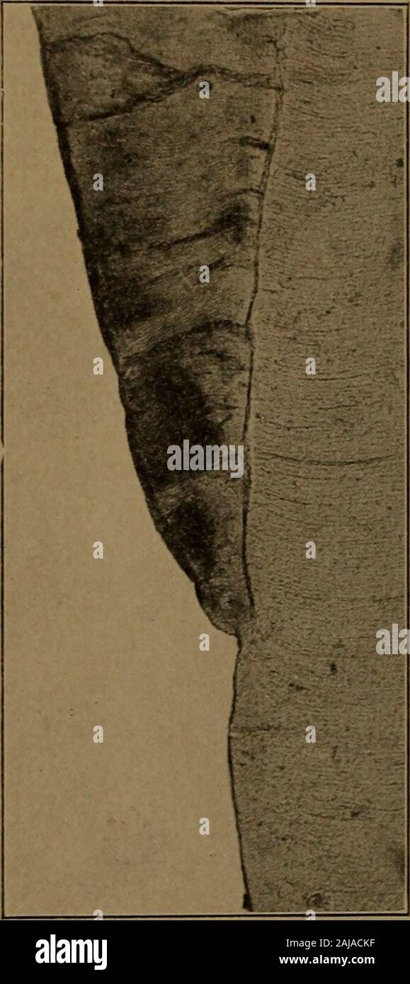 Un texte-livre d'Histologie et Embryologie dentaire, y compris les directions de laboratoire . red une condition normale,et l'auteur a des raisons de supposer que la sec-tions montrant cette condition étaient des dents qui thegums s'était estompée et le cément est détruit. Thesensitiveness ce qui est marqué de la sorte dans certains cas, lorsqu'thegums ont reculé au-delà de la ligne gingivale, est probablement la perte de dueto cément et la découverte de l'granularlayer de tomes. Le cément est mince et sans structure en apparence dans la partie gingivale lorsque vu avec de faibles puissances, mais devient plus épaisse dans la partie apicale Banque D'Images