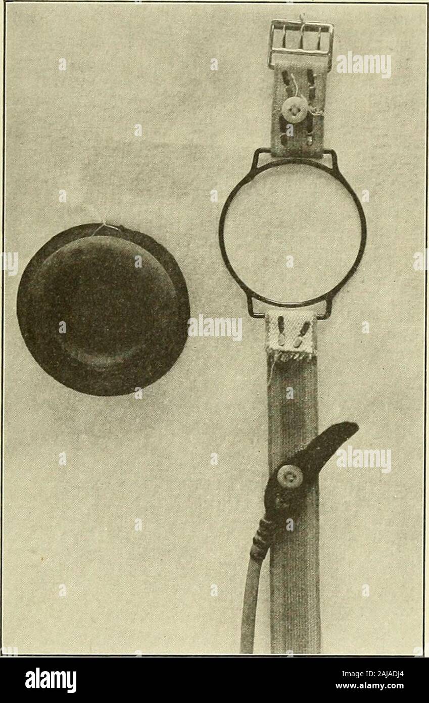 Travaux préparatoires et après le traitement dans le cas du dispositif .  Fig. 316.-tampon de colostomie périnéale et abdominale avec bretelles.  TheStraps sont fixés sur les boutons sur la ceinture. 504 505